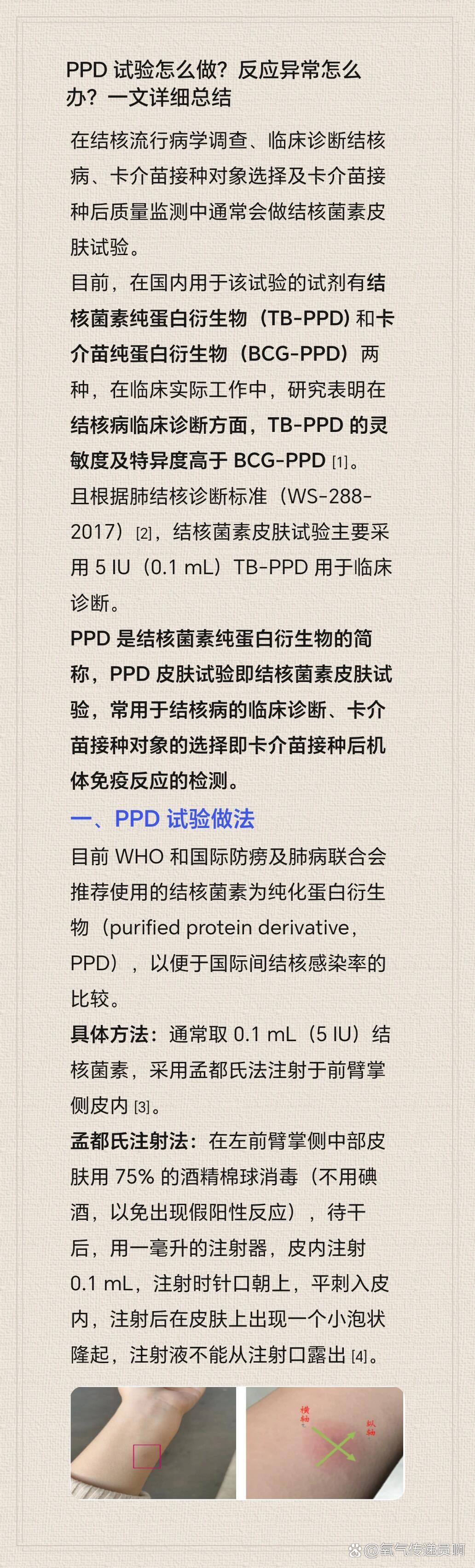 ppd皮试结果怎么看图片