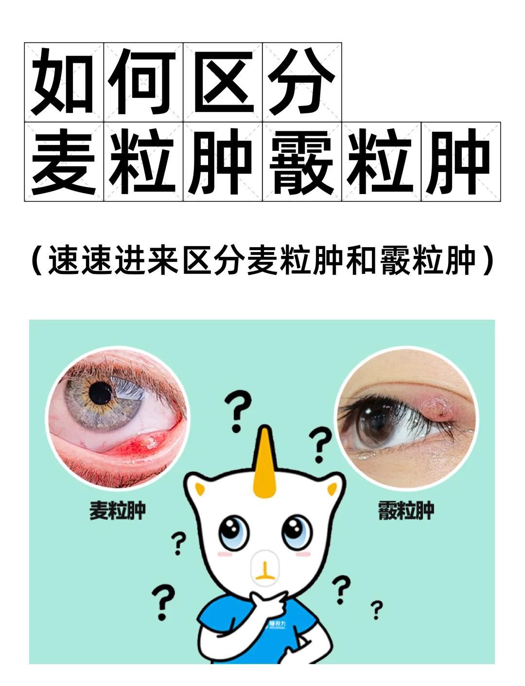 麦粒肿和霰粒肿的区别及治疗方法👀
