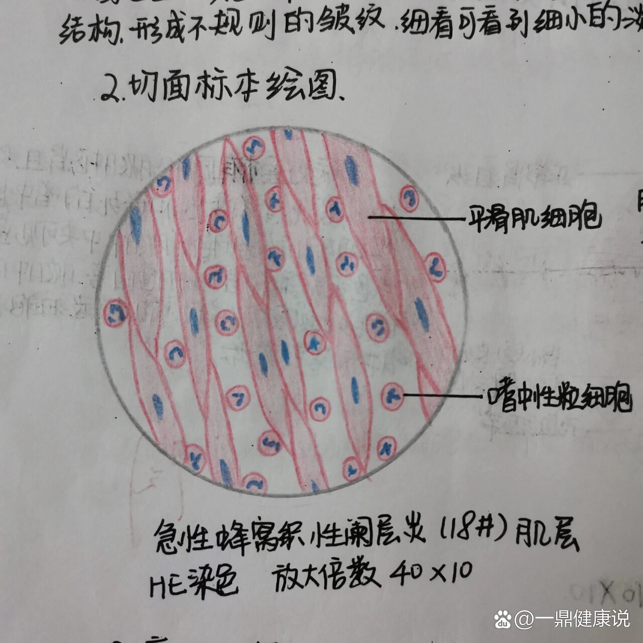 阑尾肌层图片