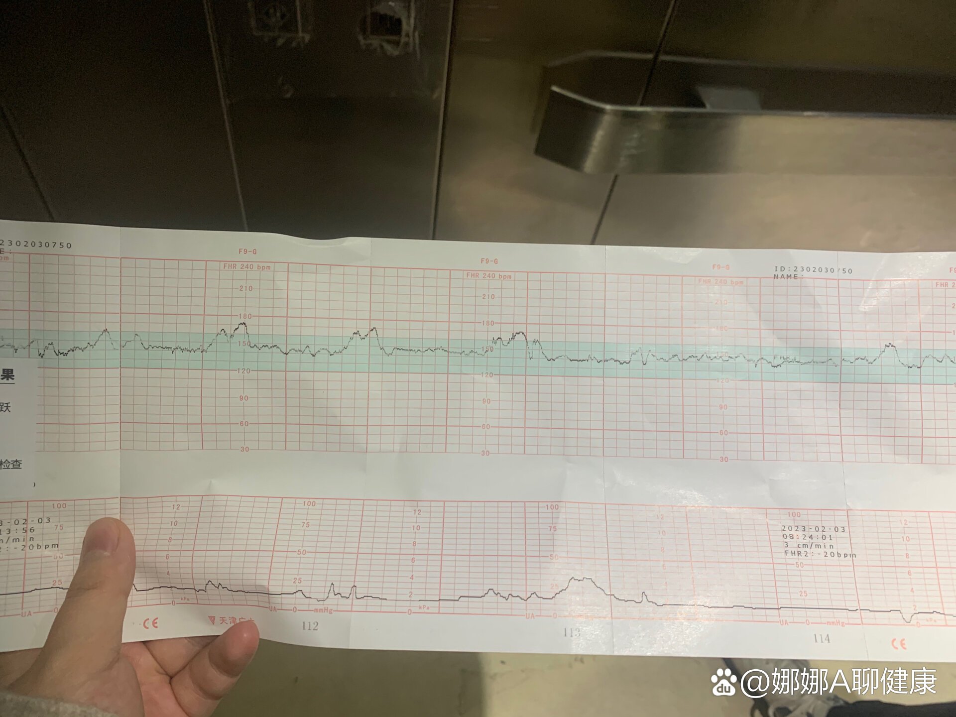 好标准的胎心监护图哈哈哈哈