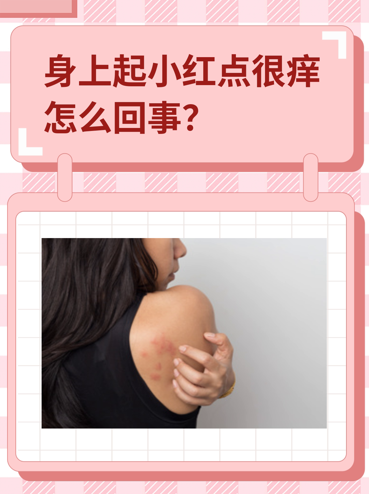 为什么一到晚上皮肤痒白天不痒为什么在线 为什么一到晚上皮肤痒白天不痒为什么在线