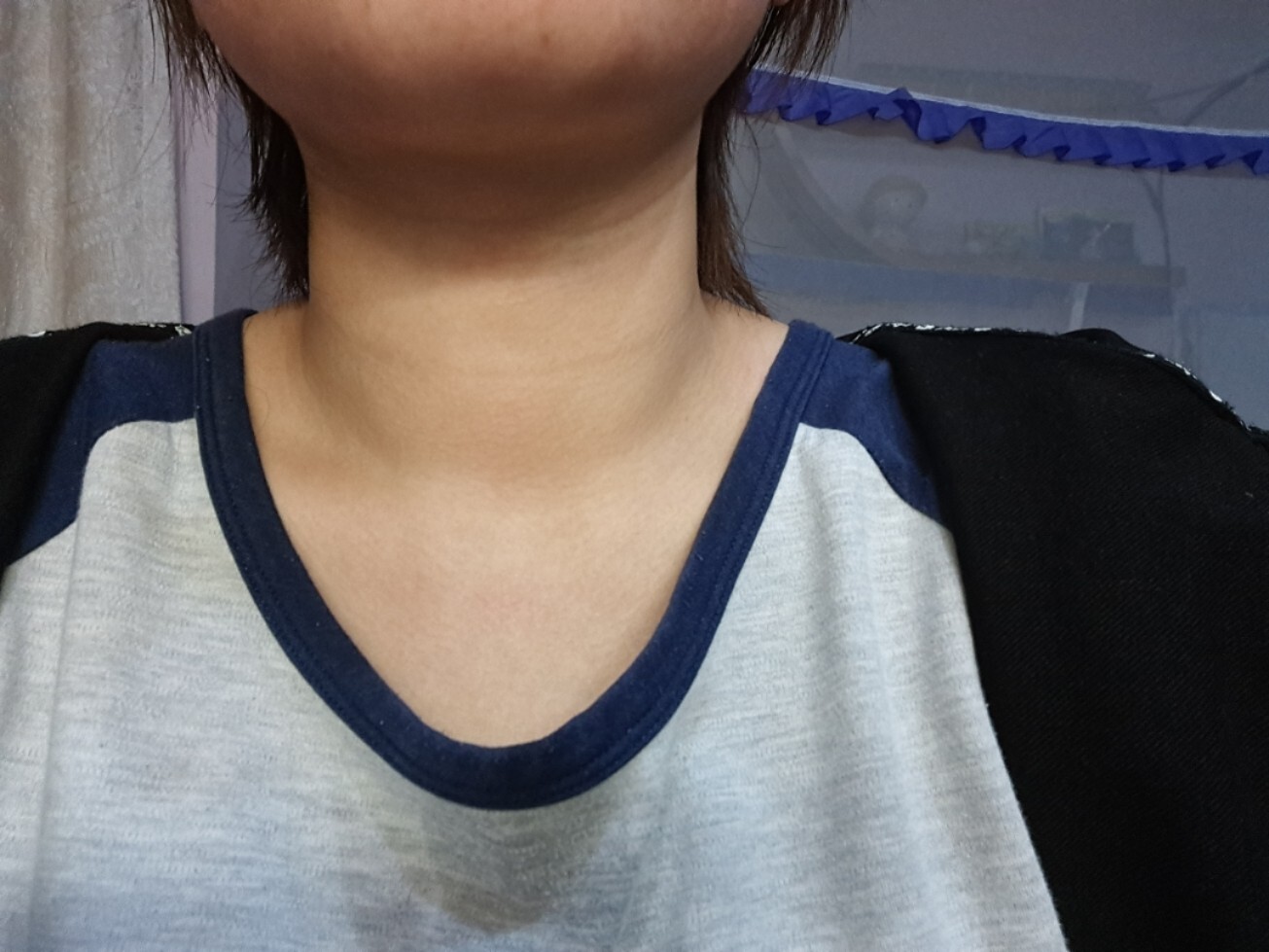 甲亢之检查历程