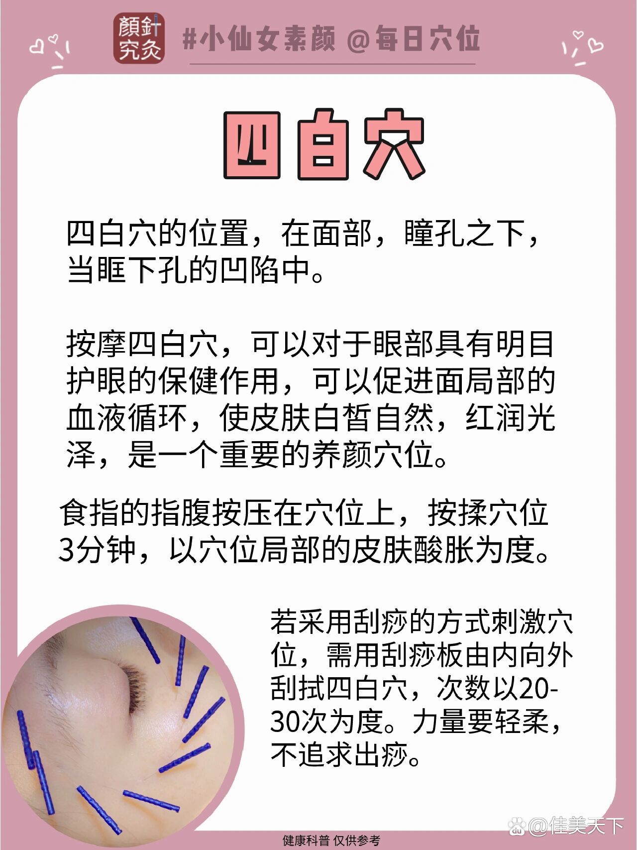 针灸美容穴位94四白穴面部美白第一要穴75