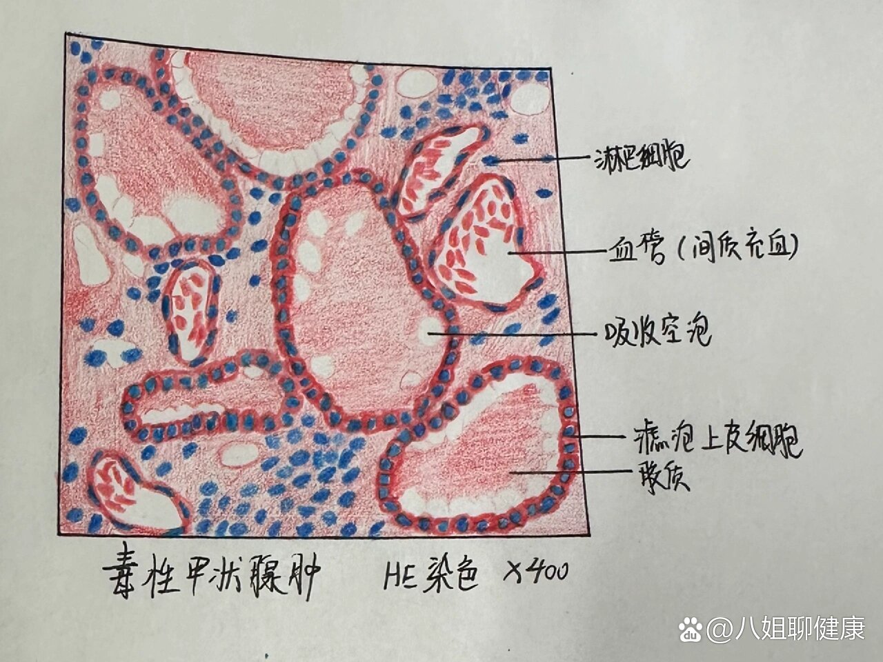 甲状腺切片手绘图图片