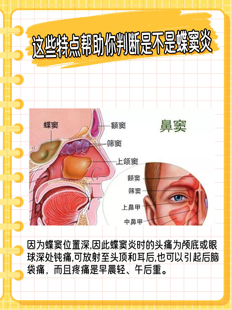 闻不到味道还以为是感冒了,结果是蝶窦炎