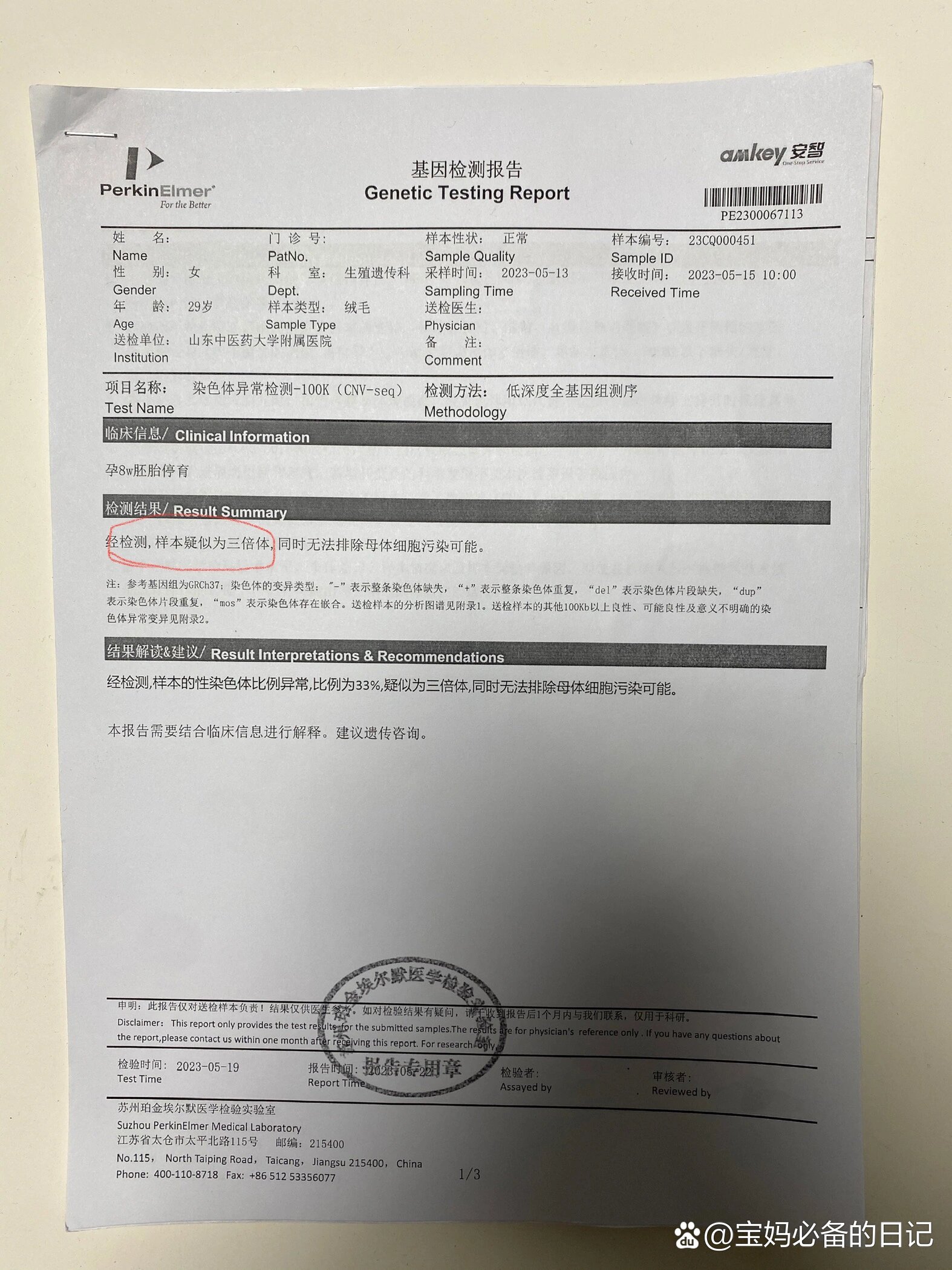 染色体结果出来了,胚胎三倍体