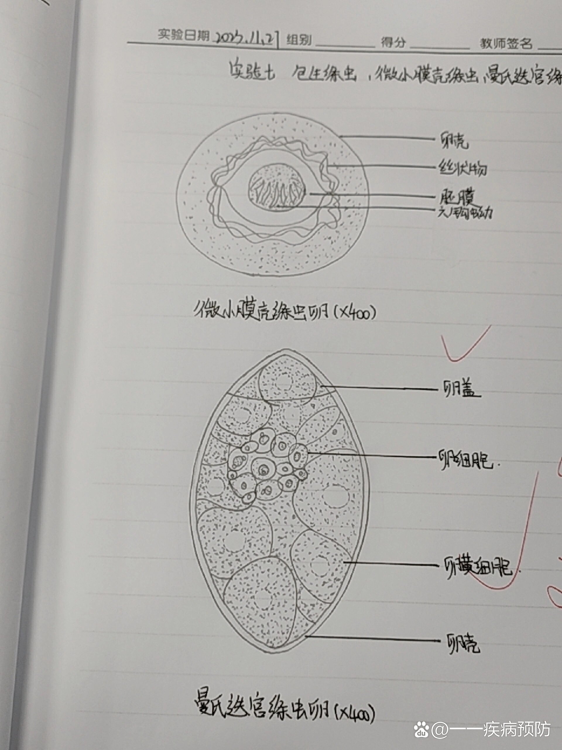 微小膜壳绦虫卵,曼氏迭宫绦虫卵