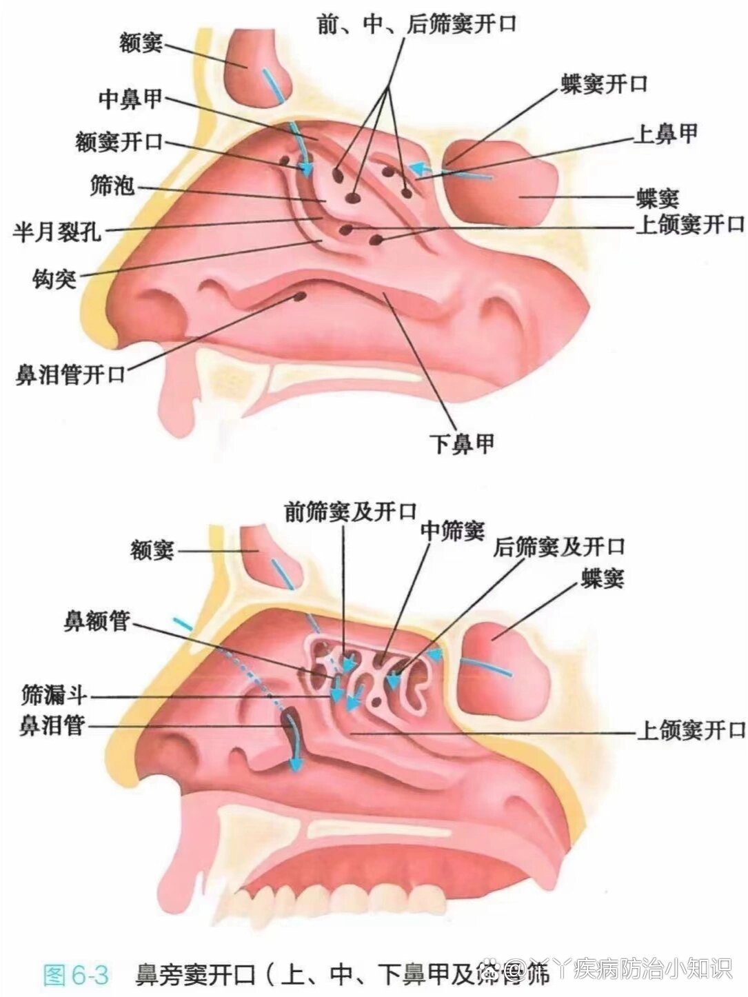 鼻甲肥大在哪个位置图片