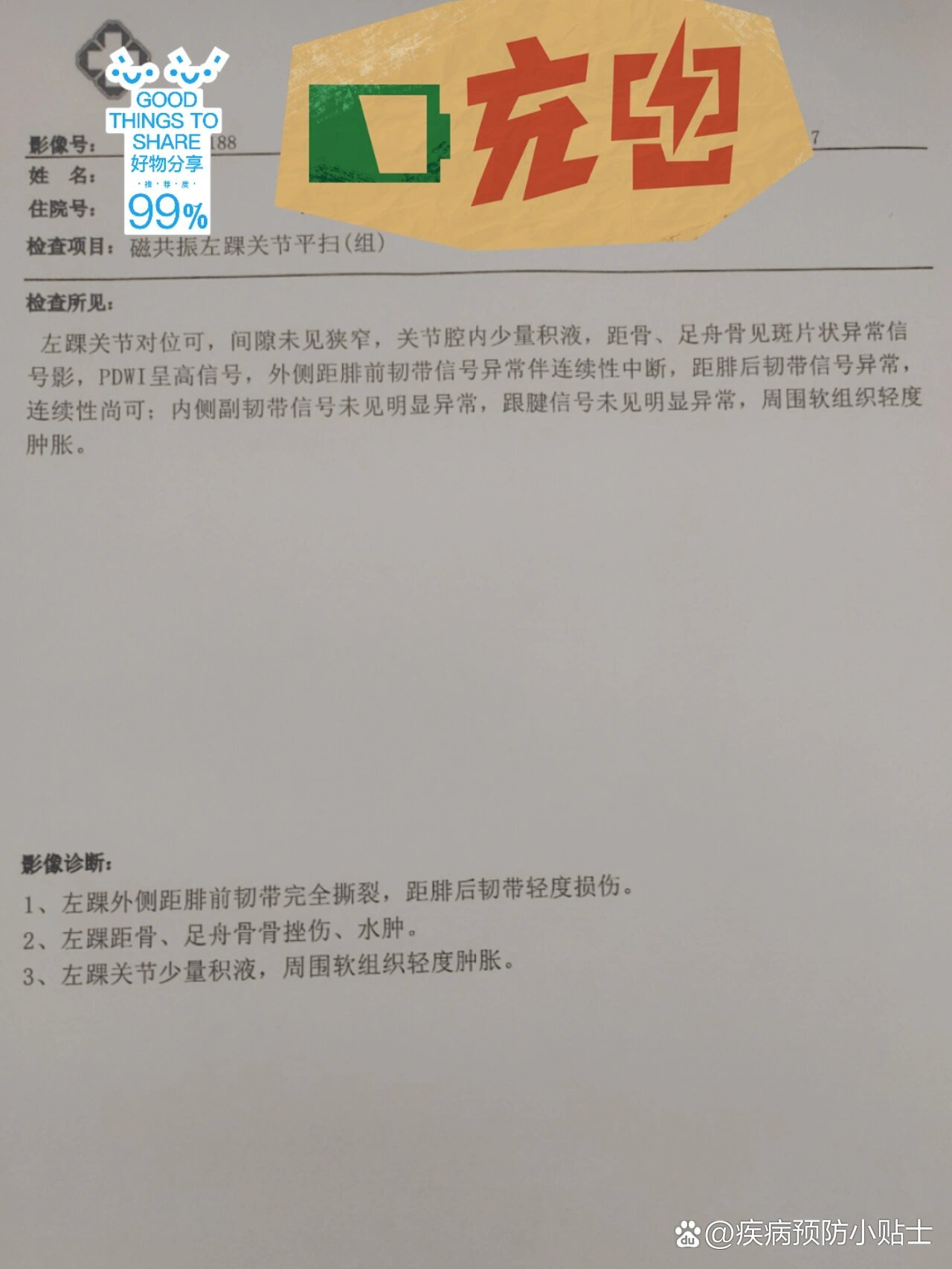 左踝距腓前韧带撕裂要不要手术?