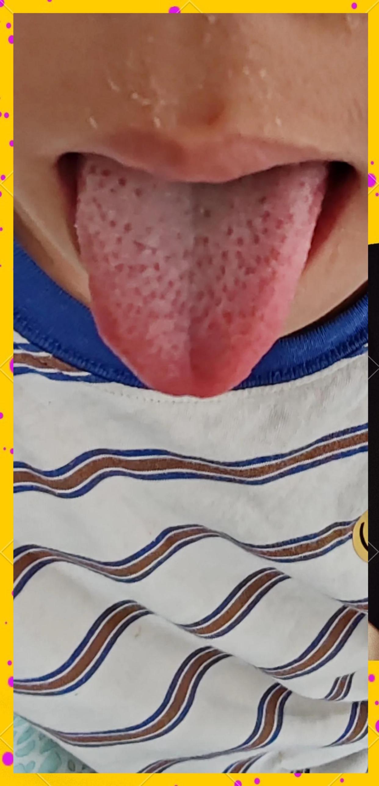 阴虚火旺与阴盛格阳：中医的深层理解