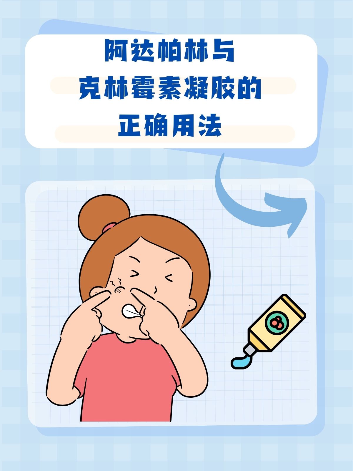 阿达帕林与克林霉素凝胶的正确用法