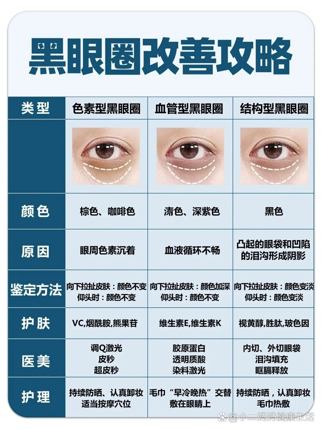 黑眼圈的另一种说法图片