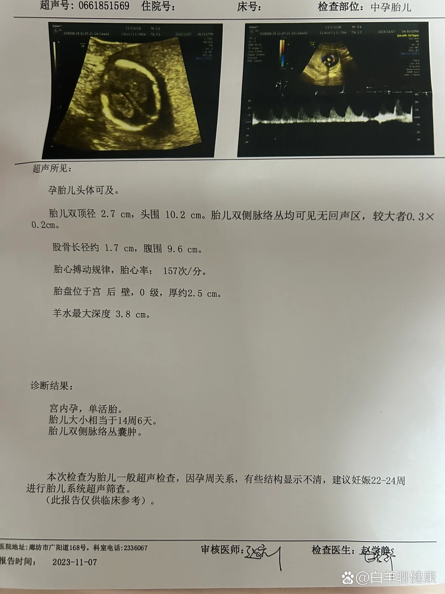 孕期日记|胎儿脉络丛囊肿消失啦