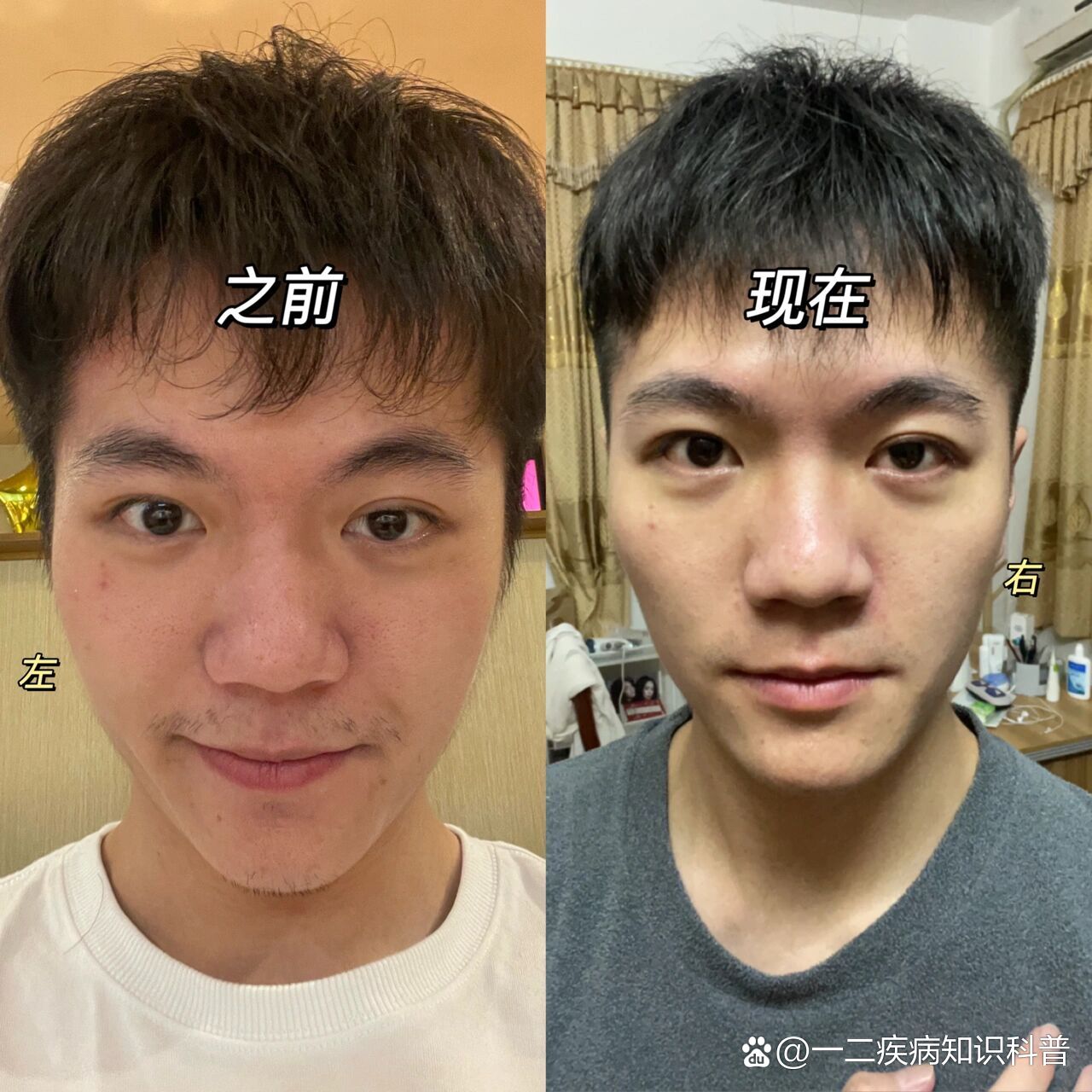 千万不要一直单侧咀嚼!