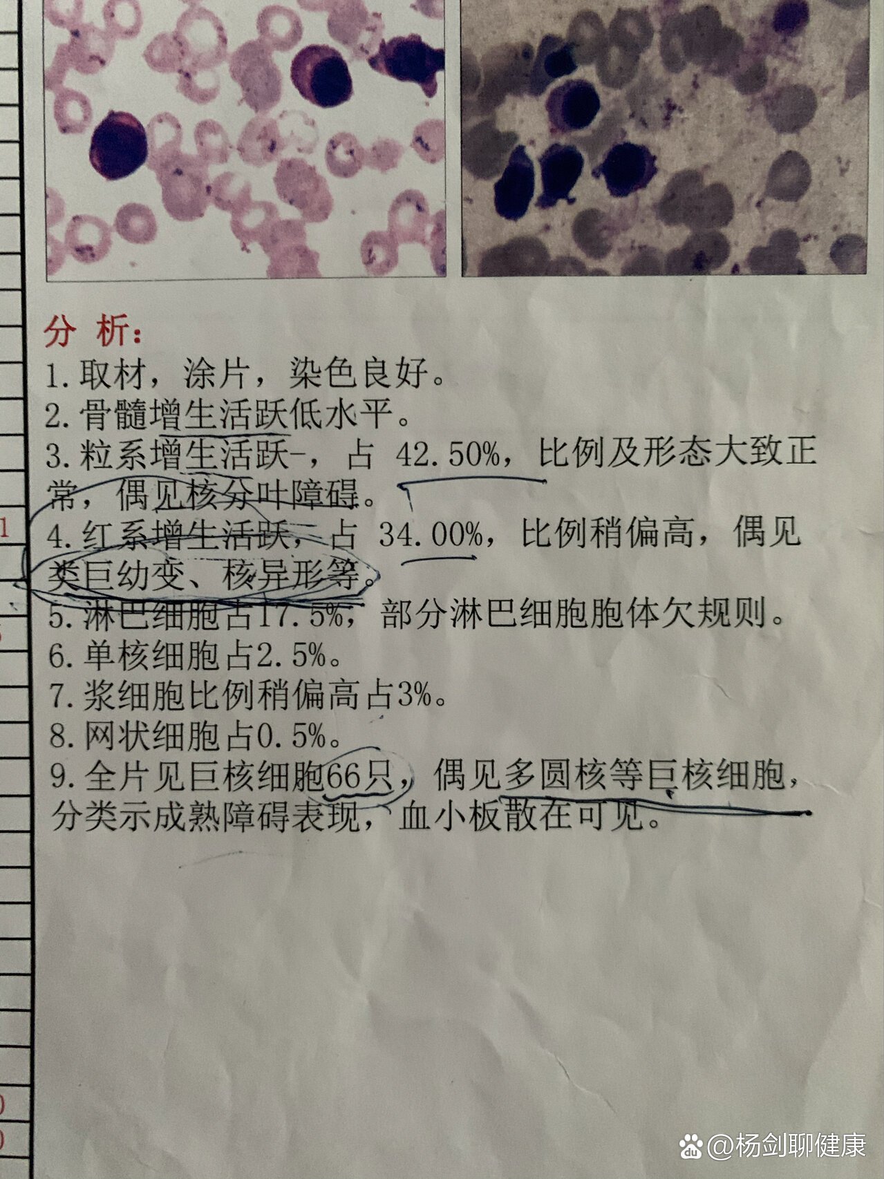 骨穿报告图片