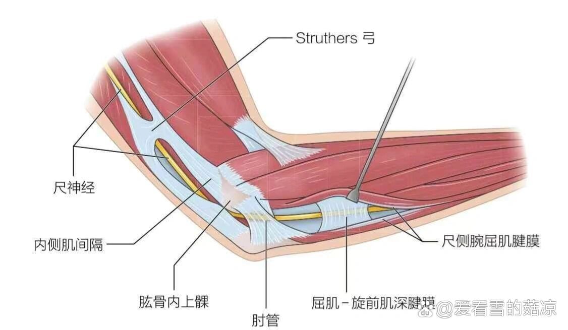 肘管综合征肌电图正常图片