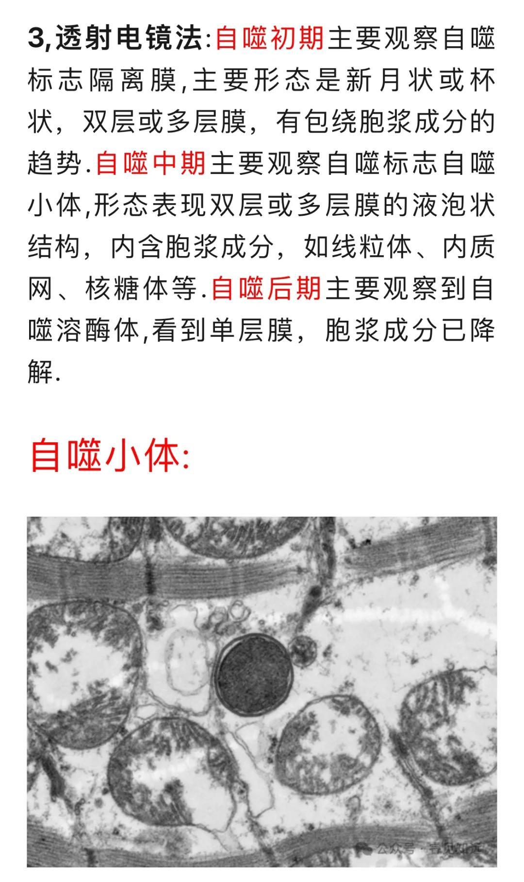 透射电镜下的细胞自噬全过程