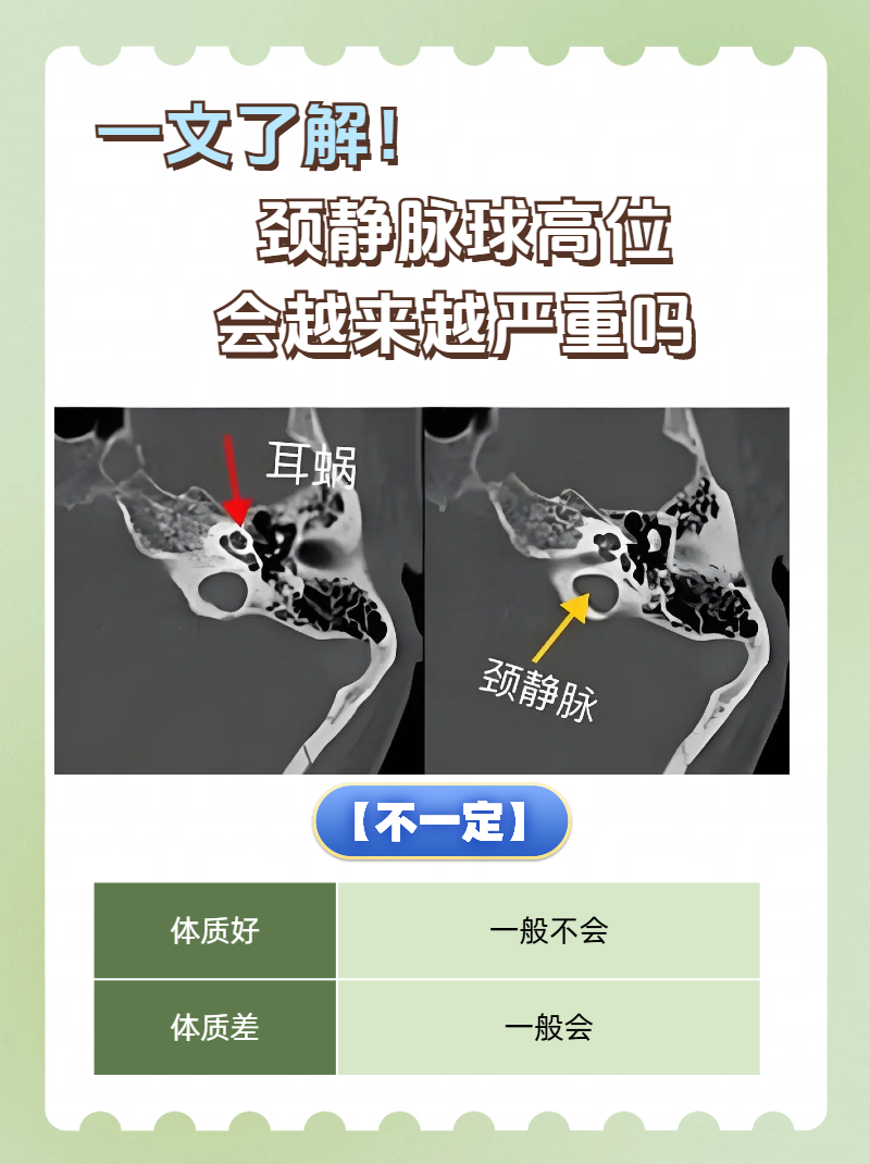 颈静脉位置示意图图片