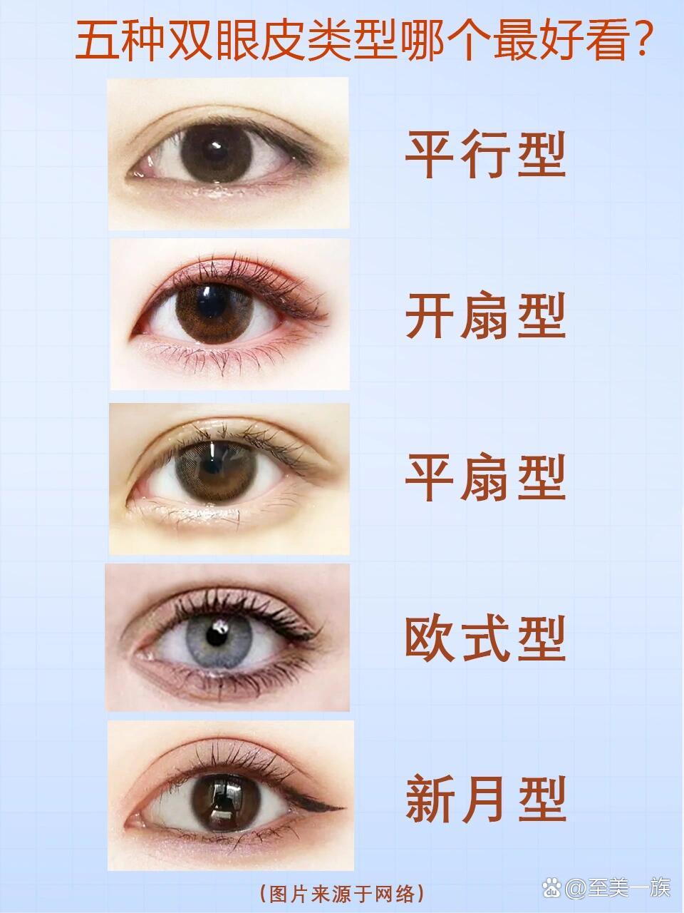 平行型,开扇型,平扇型,你的是什么型?