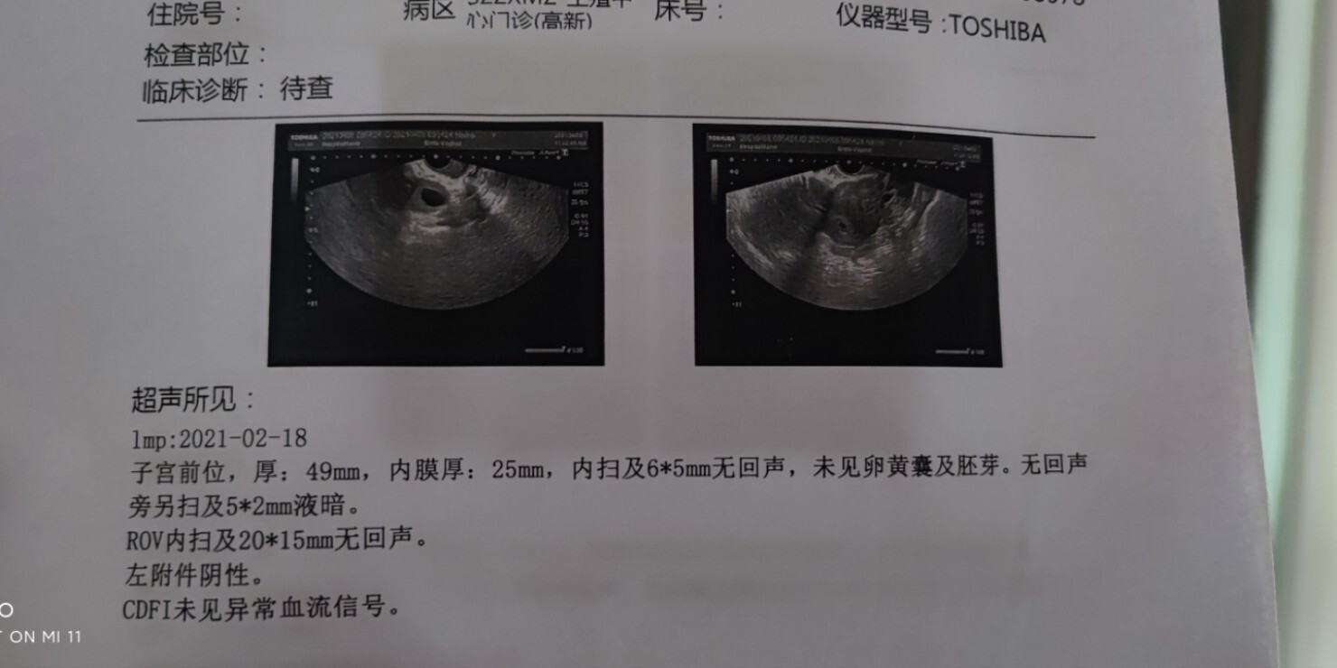 七周未见卵黄囊