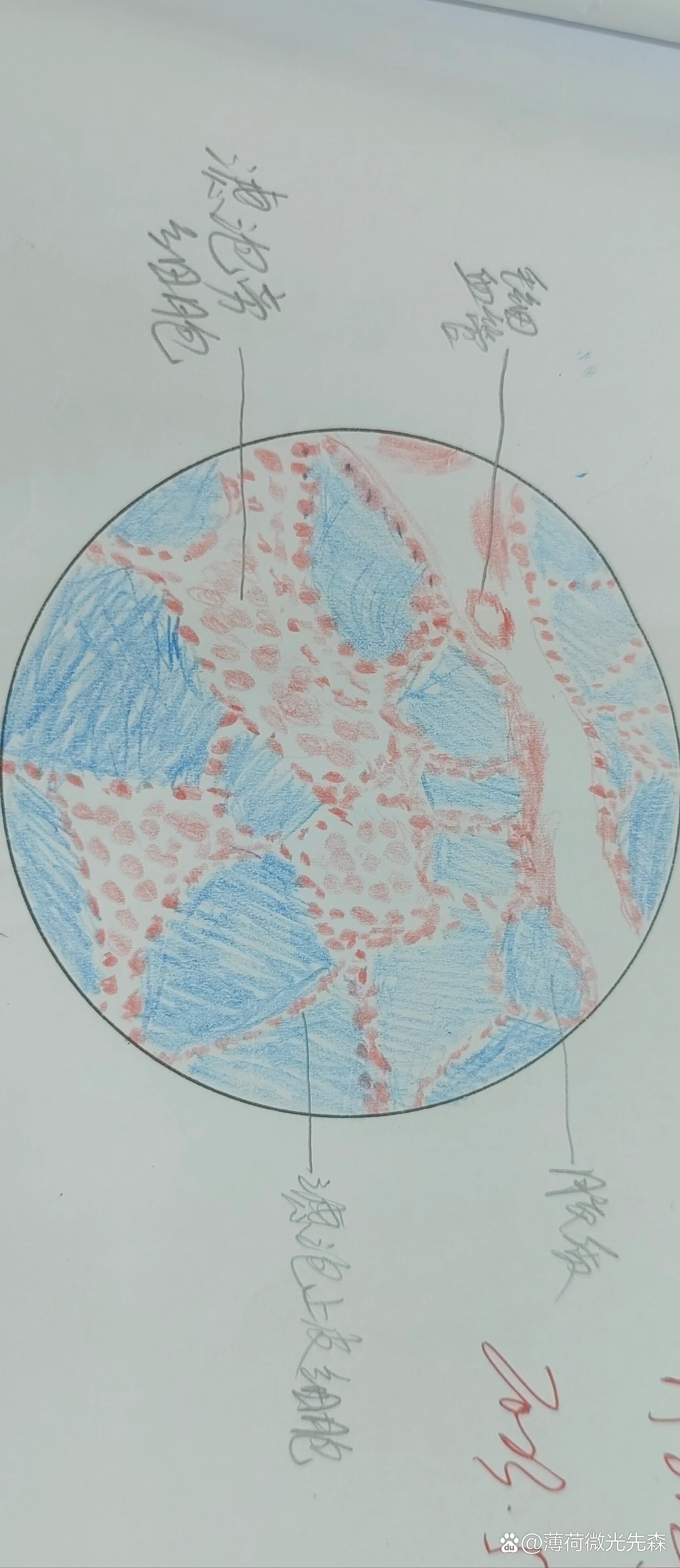 甲状腺切片手绘图图片