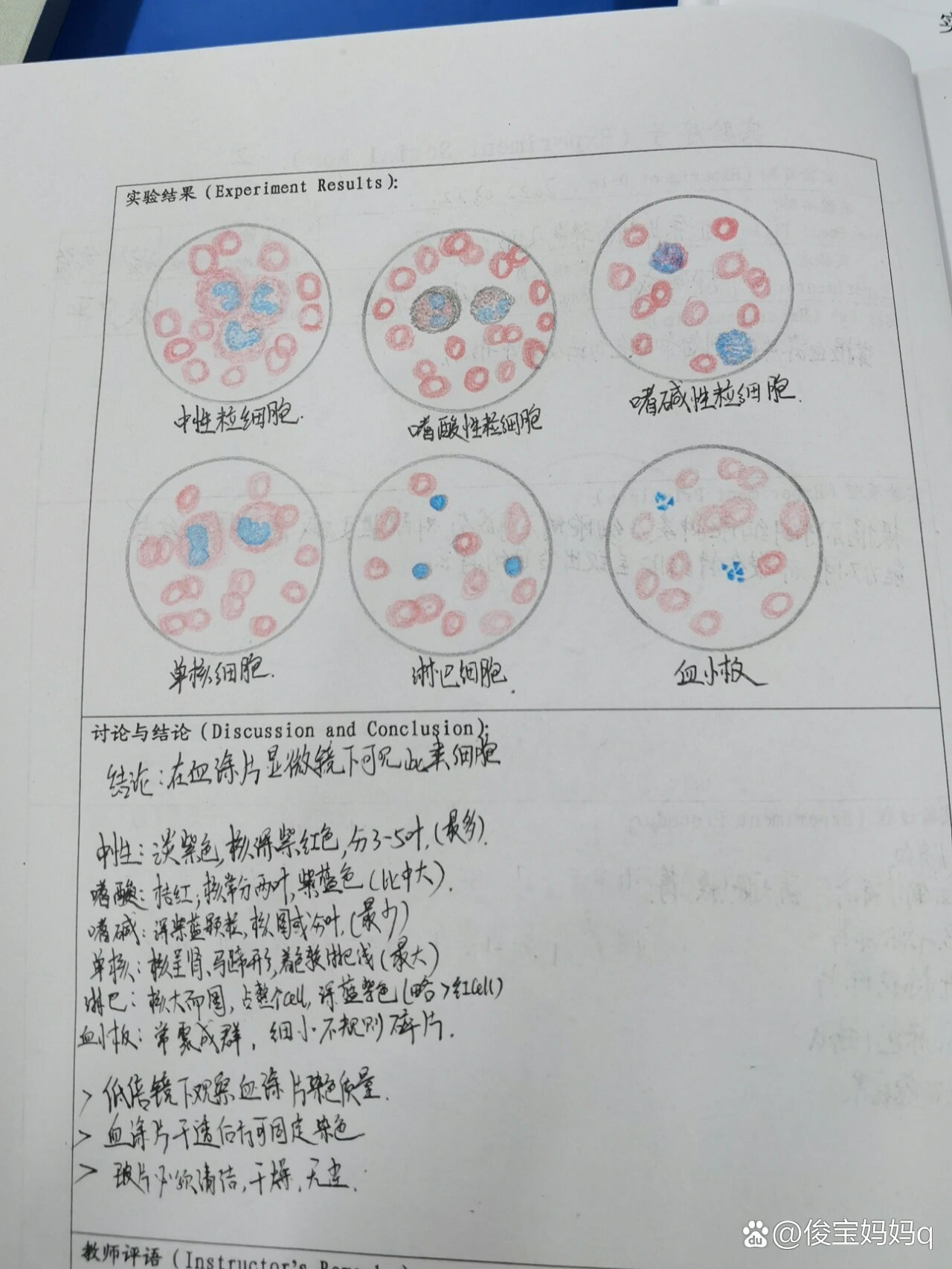 5种白细胞形态绘图图片