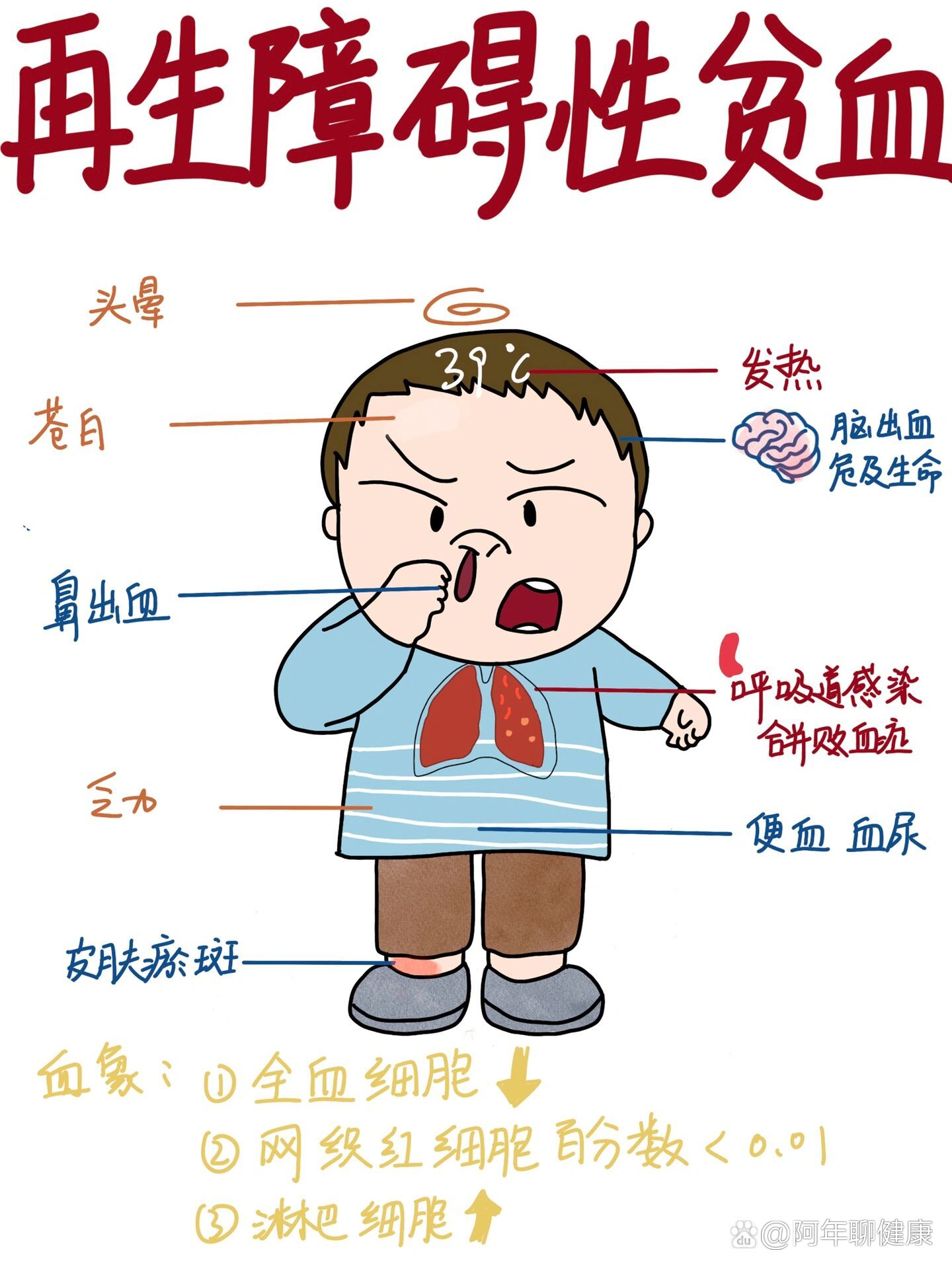 医学生笔记|再生障碍性贫血