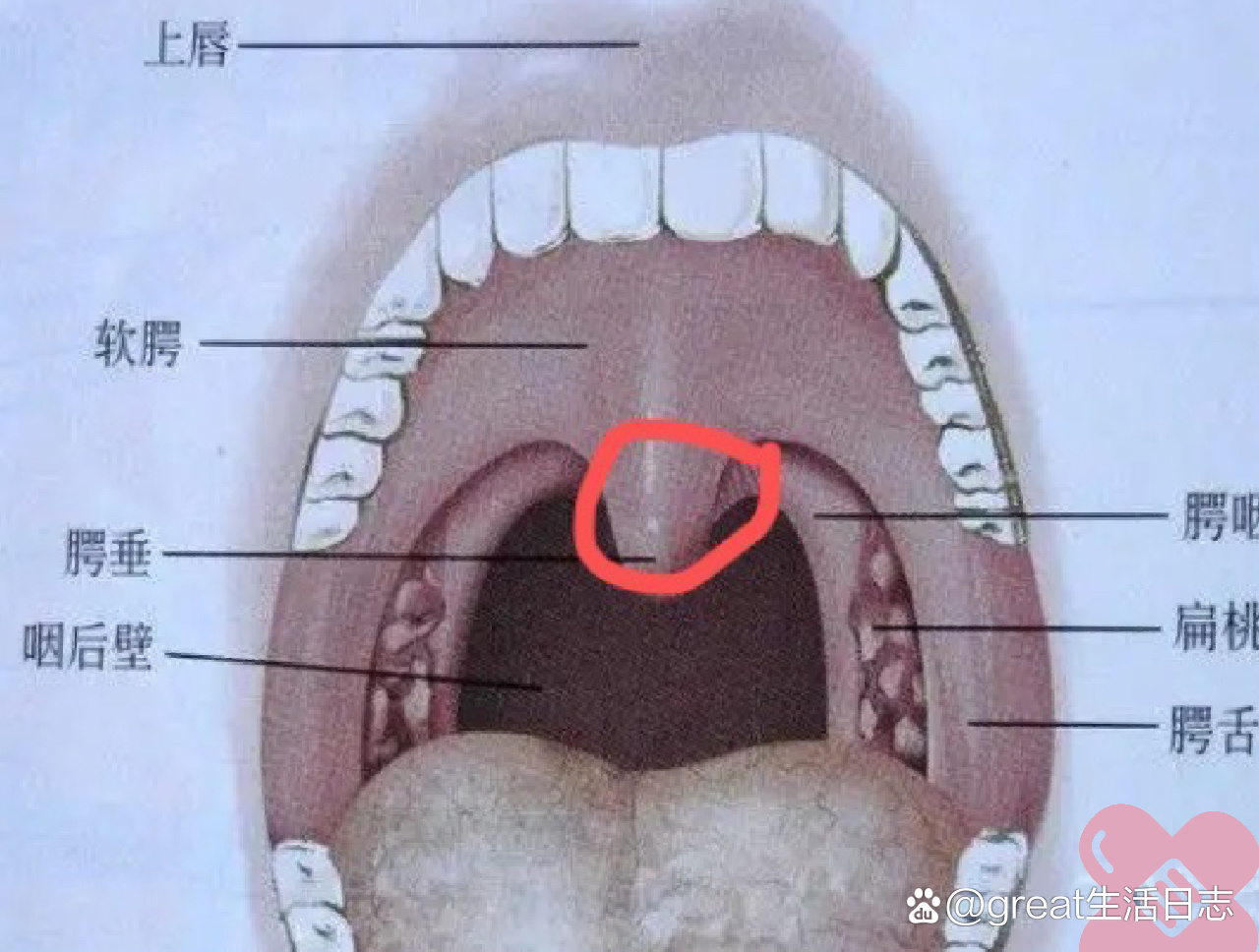 小舌头上长口腔溃疡