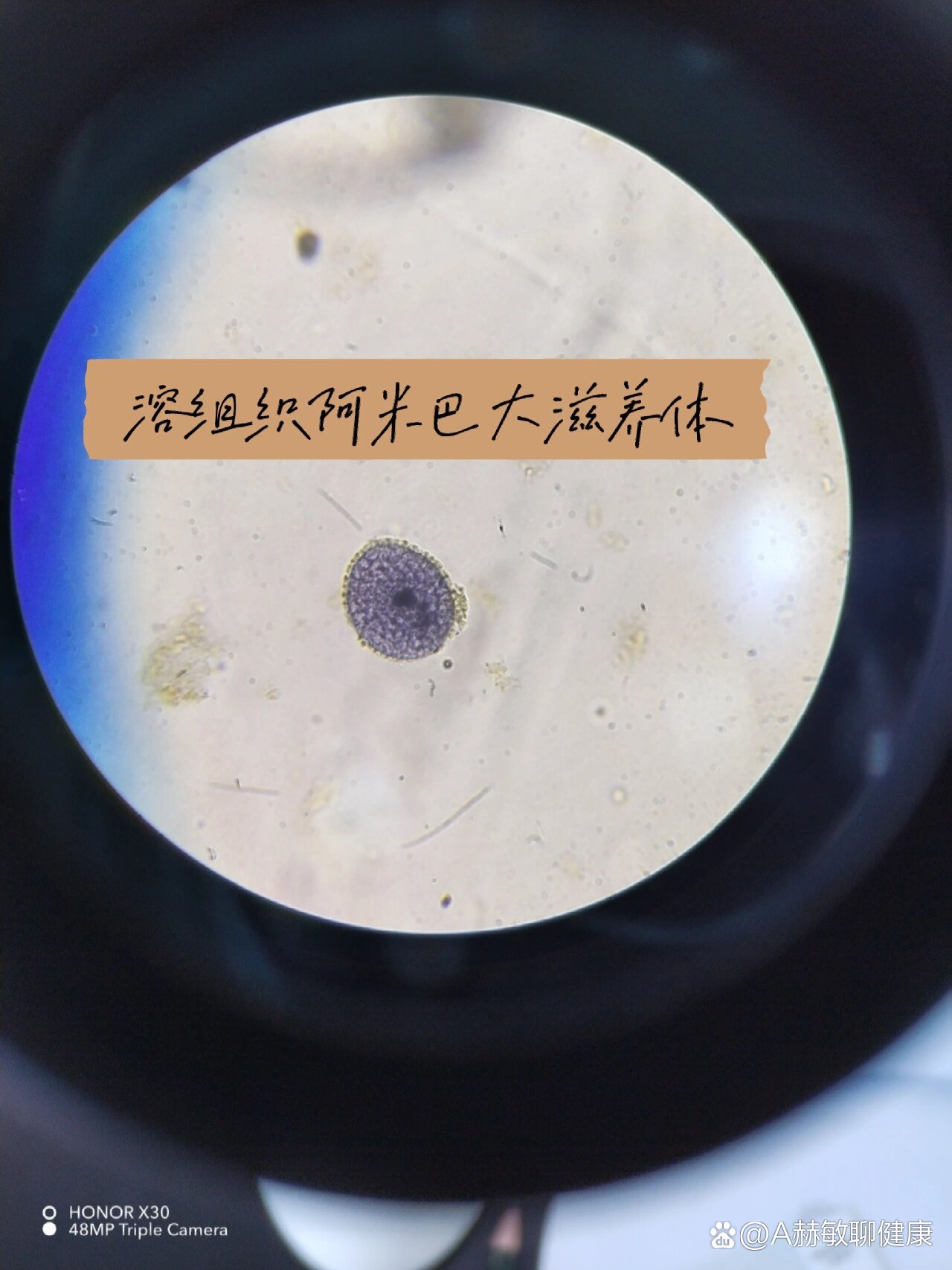 溶组织阿米巴显微镜下图