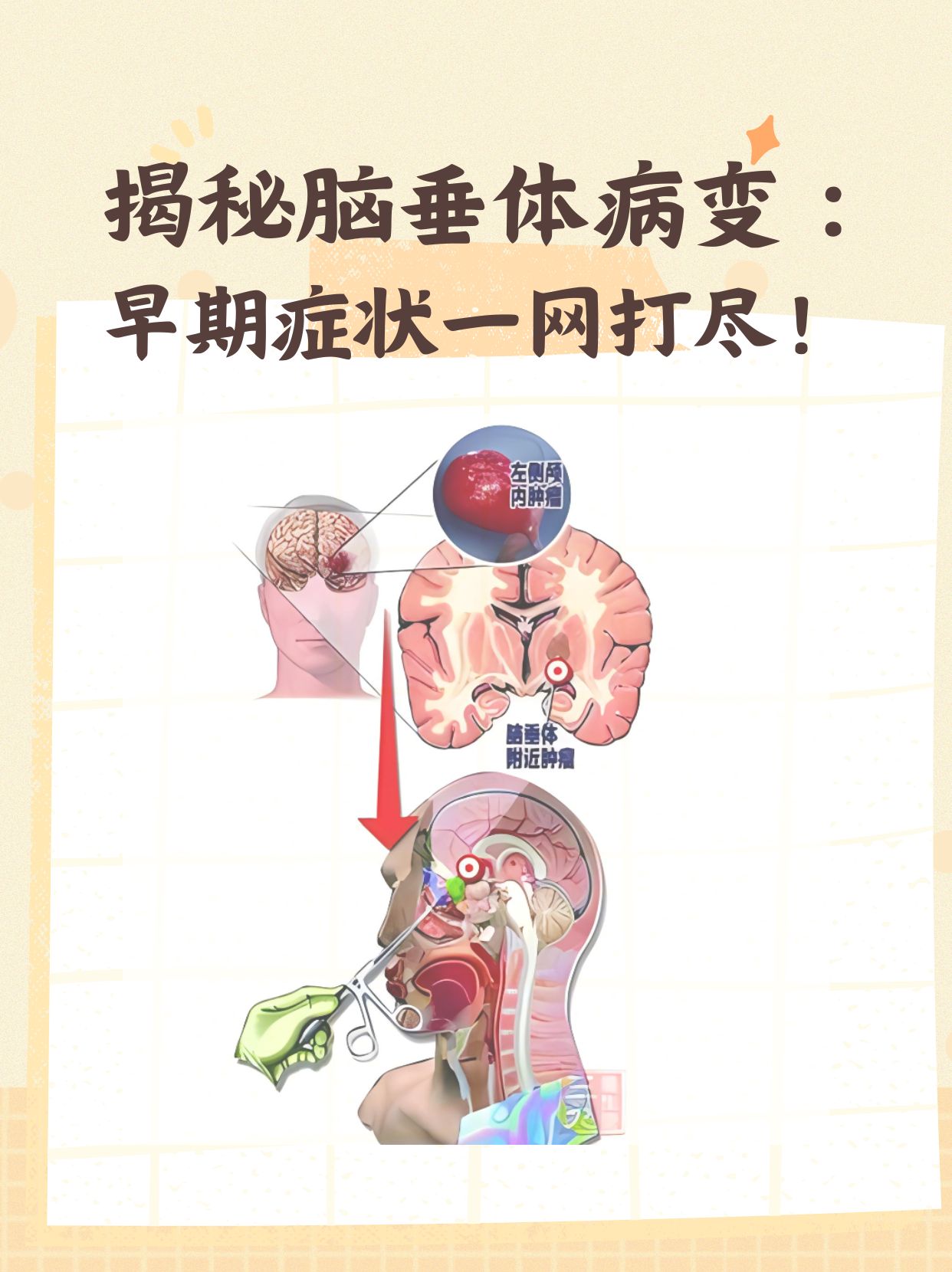 按摩脑垂体的位置图片图片