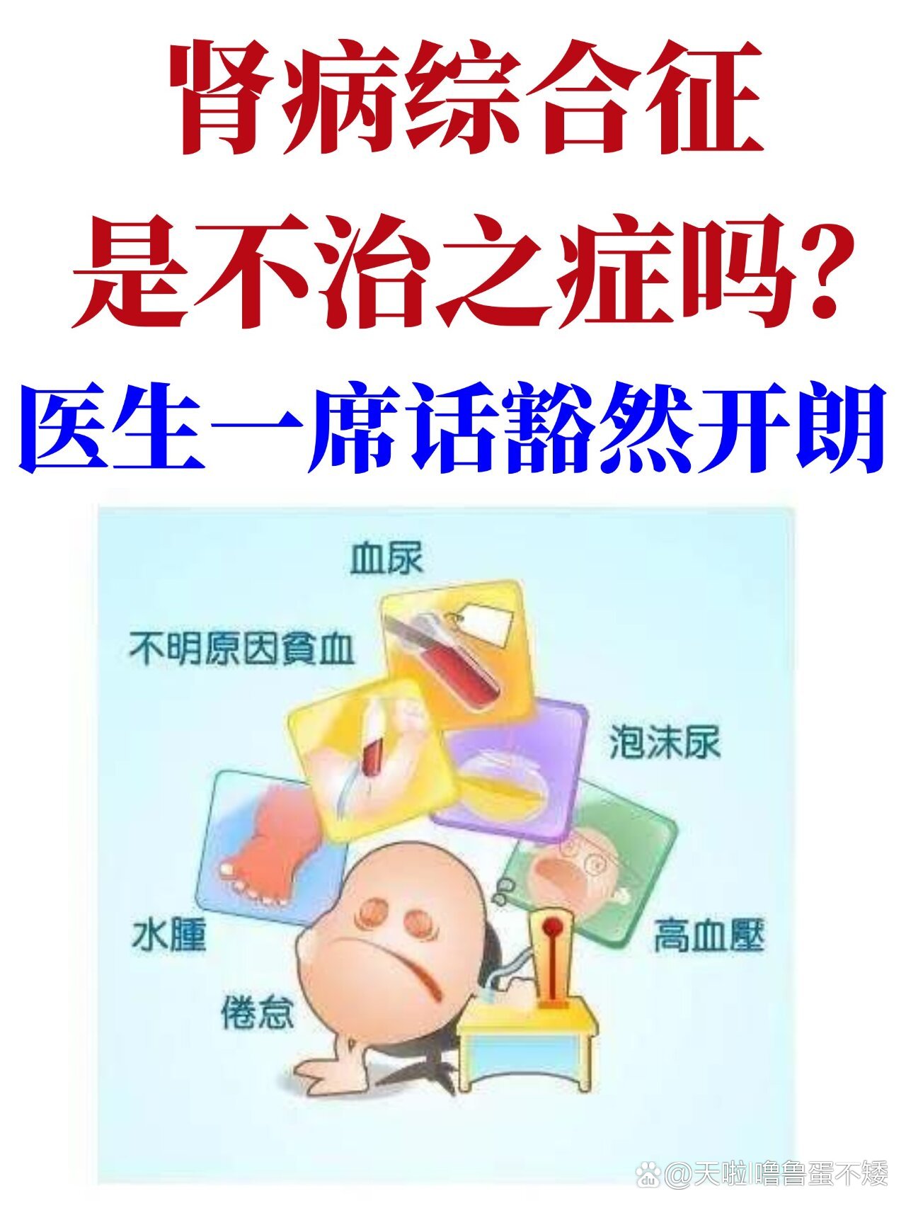 肾病综合征是不治之症?