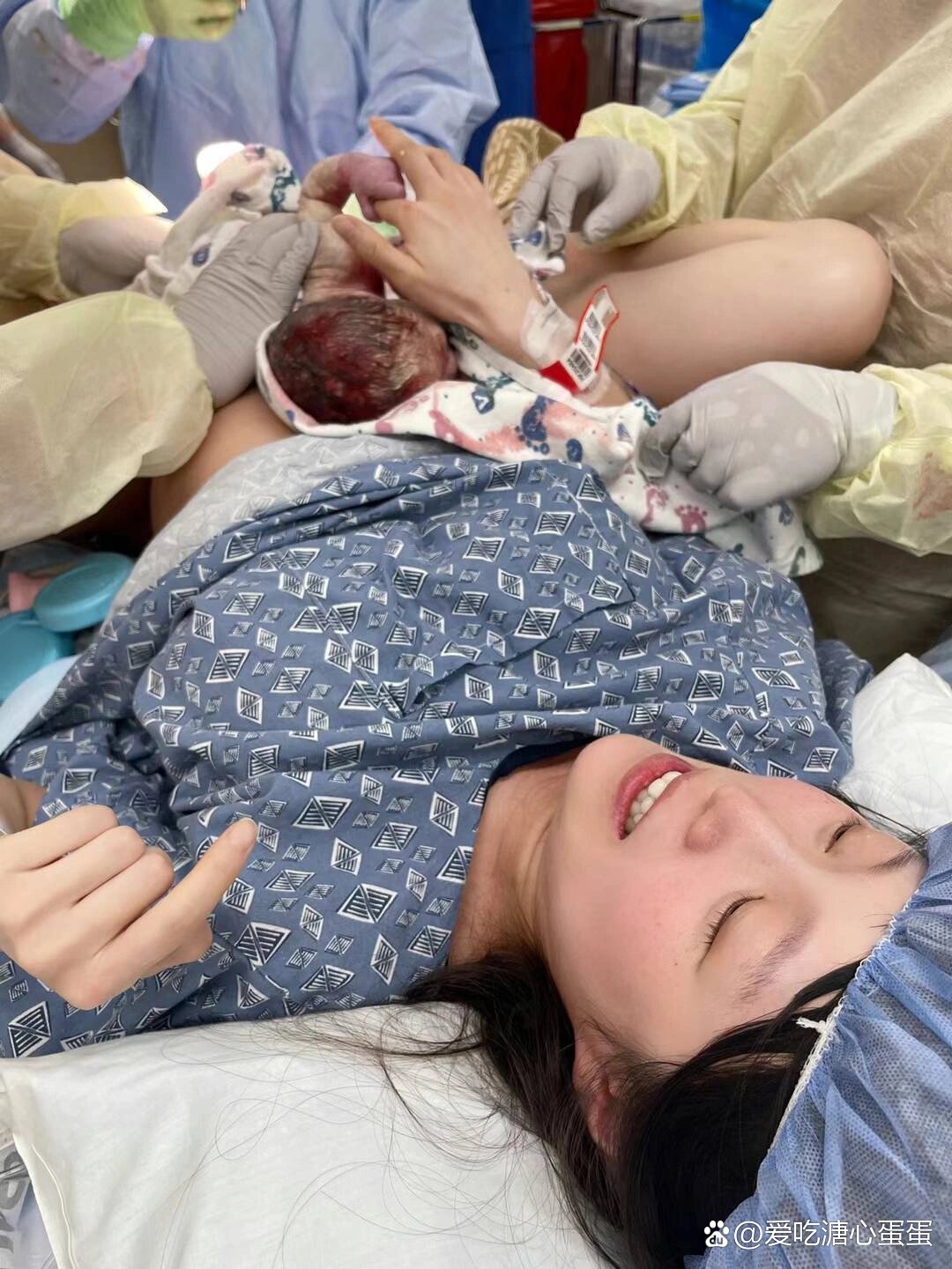 超快顺产单绒双羊双胞胎女宝,母婴同室