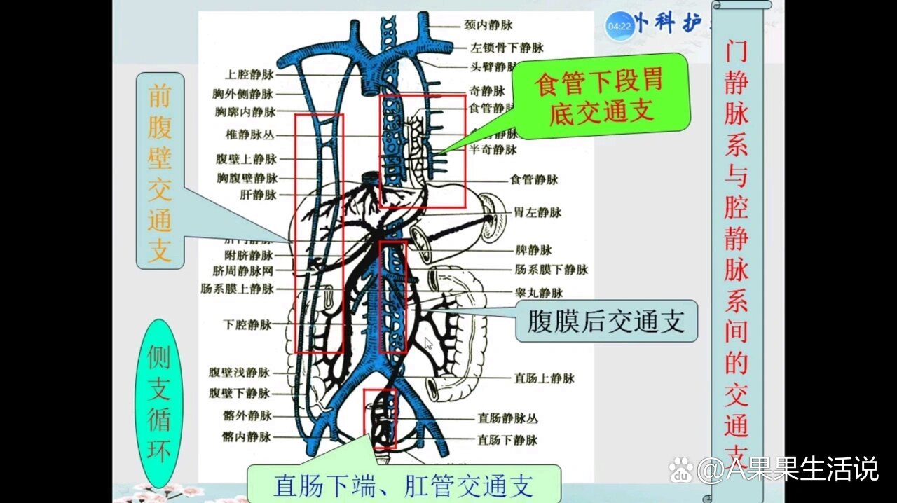 医学生画图门静脉系与腔静脉系的交通支