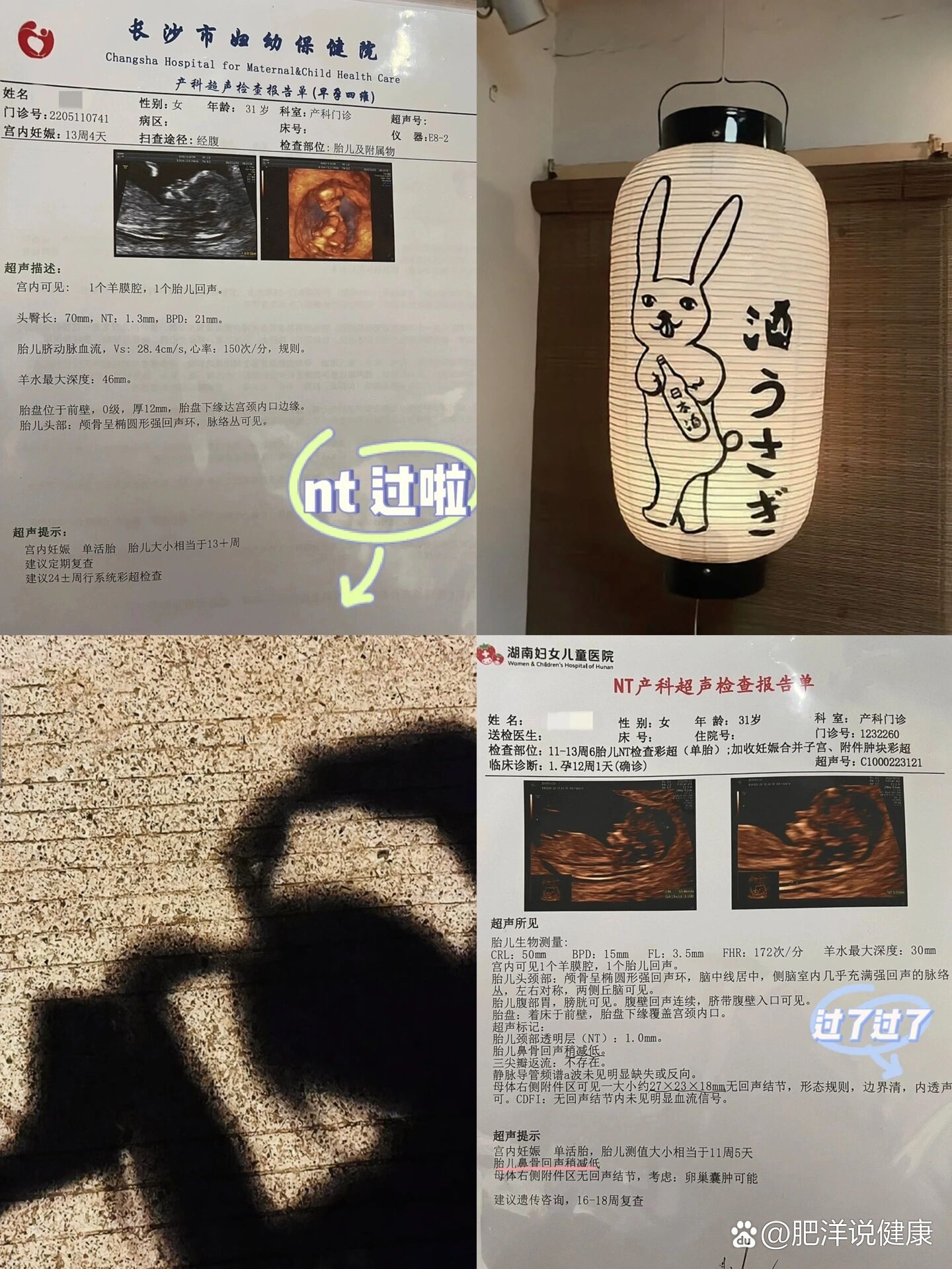 br图1是我13周按原本预约时间做的nt图4是我为了体验一下草莓医院