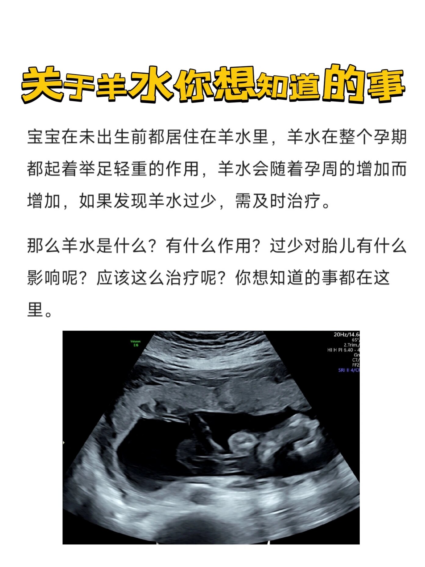 宝宝在未出生前都居住在羊水里羊水在整个孕期都起着举足轻重的作用