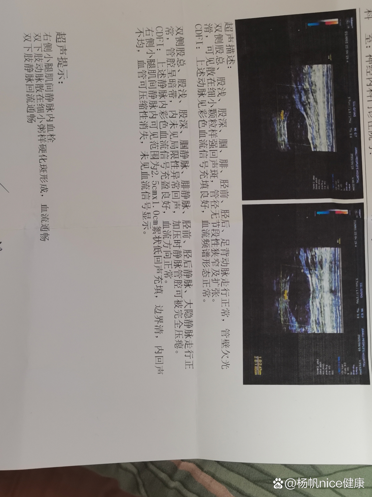 前两天彩超右侧小腿肌间静脉血栓,医生说人不在医院不敢开药,怕引起二