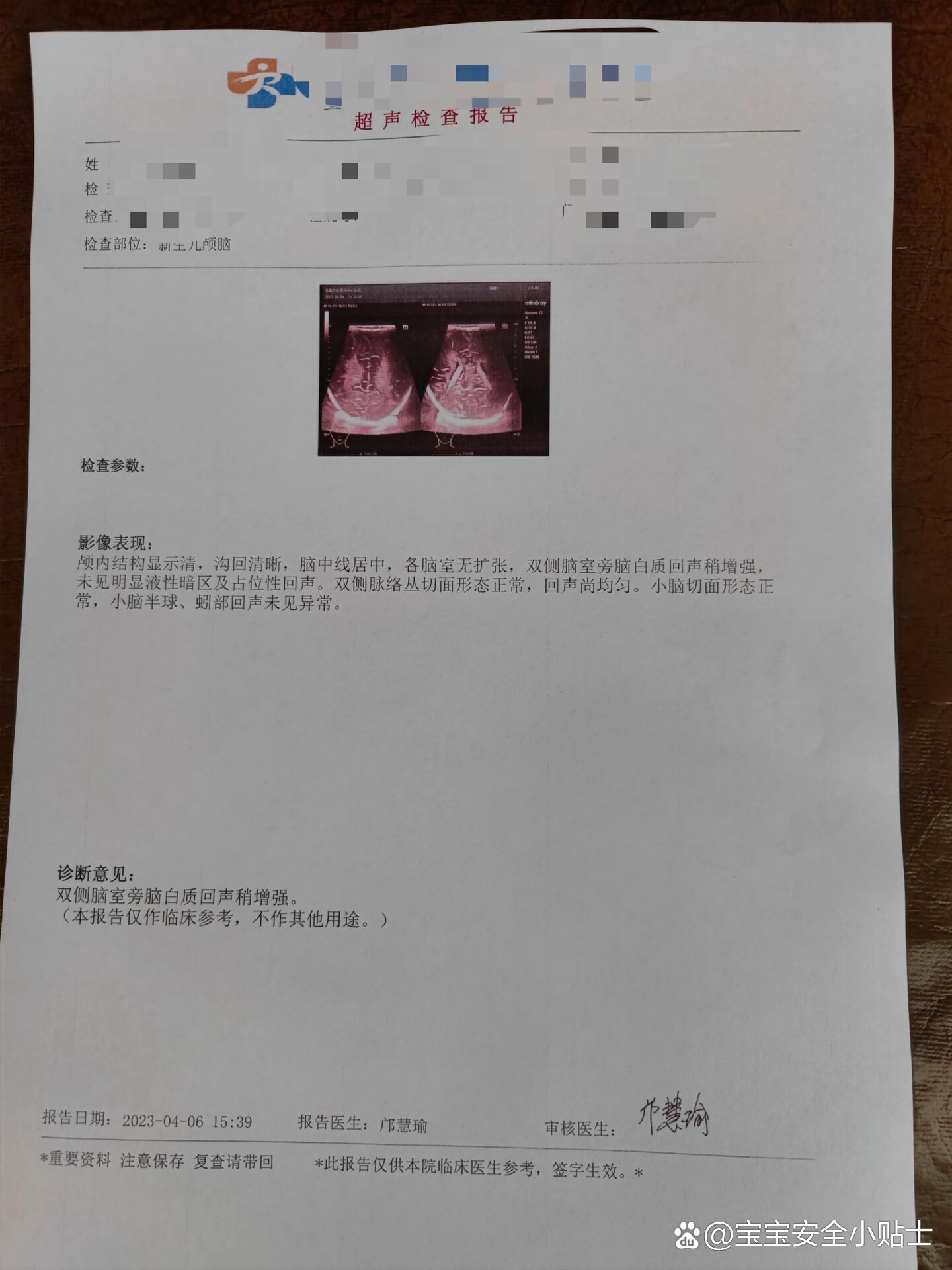 34周早产儿颅内出血25天复查结果有改善