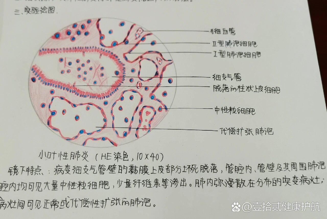 肺切片红蓝铅笔手绘图图片