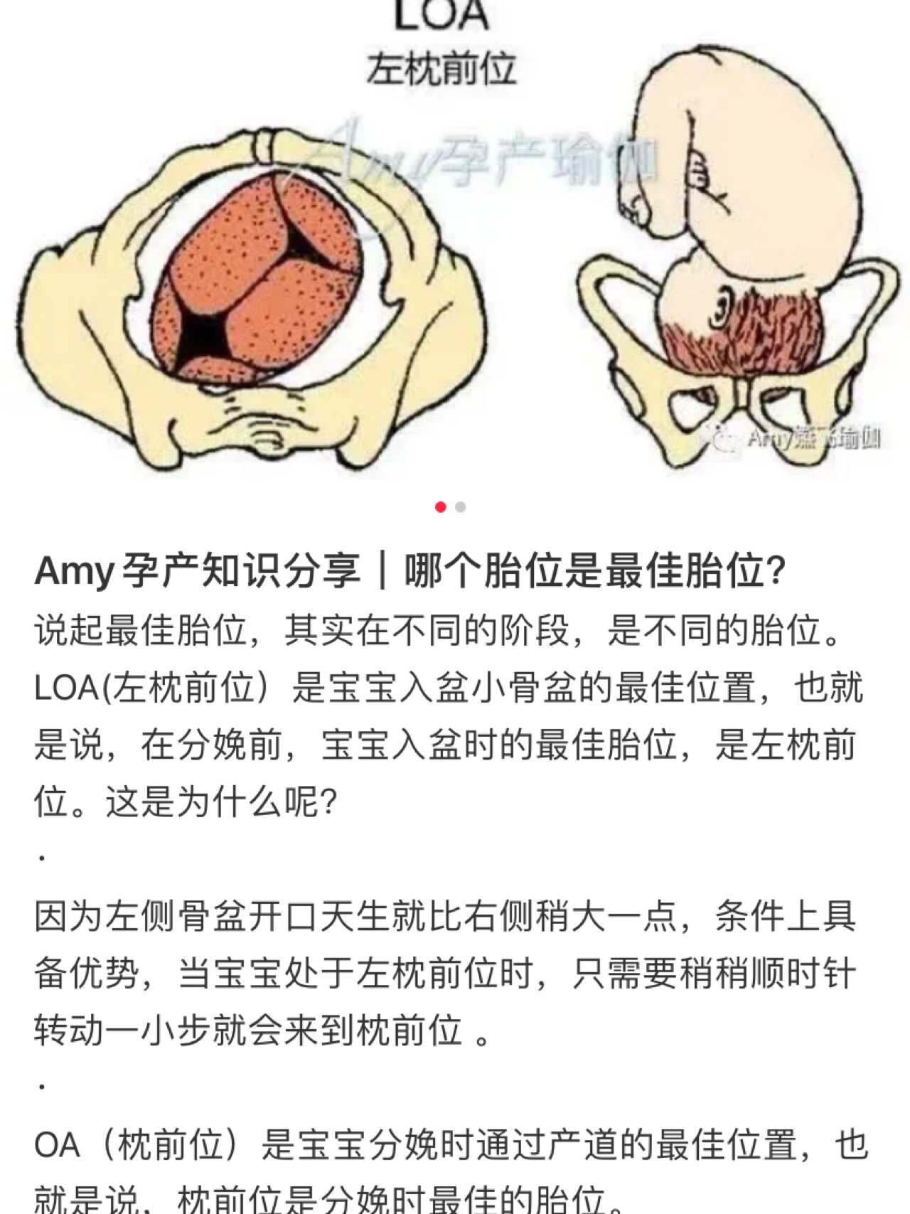 孕32周产检胎位左枕前位get✅