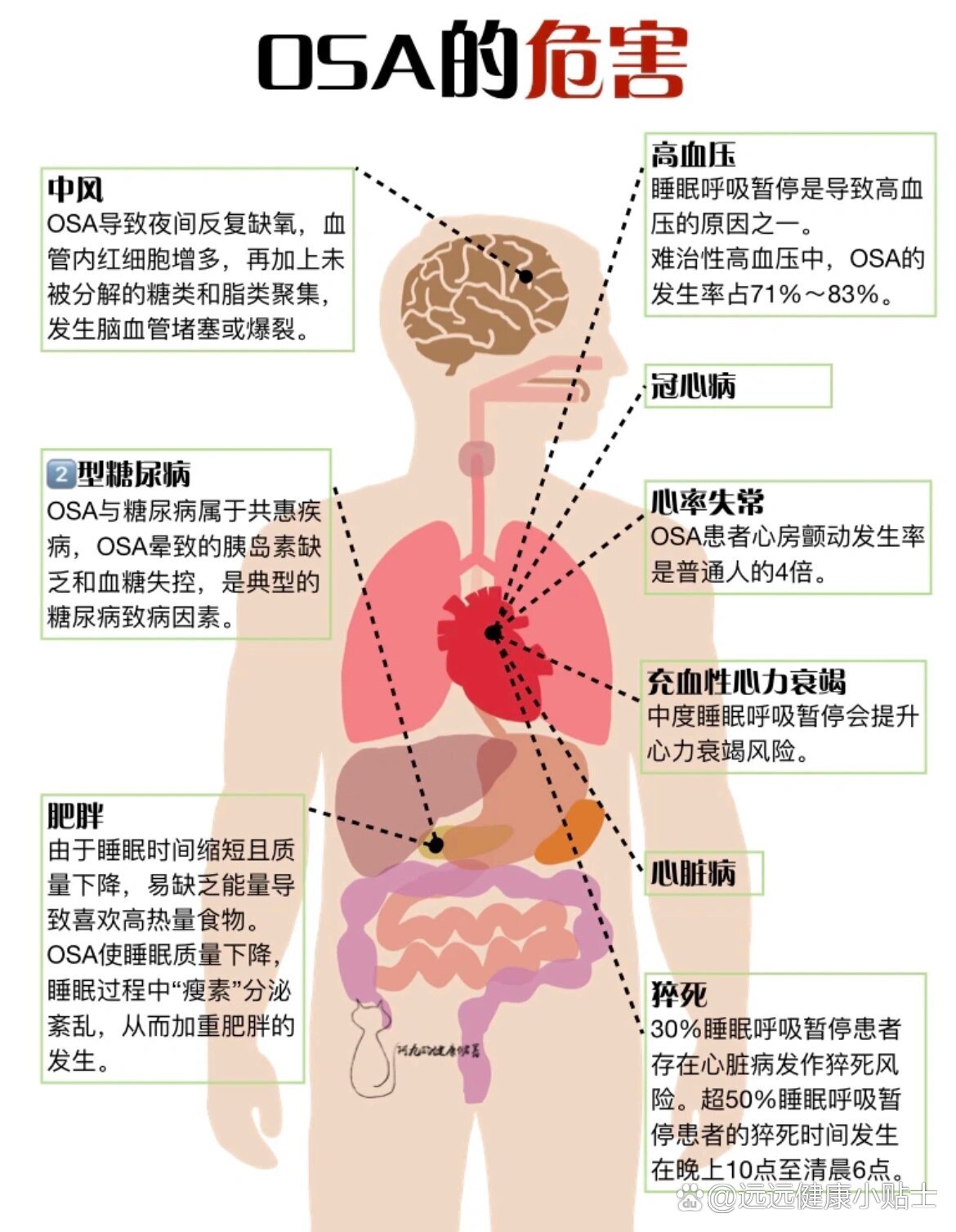 睡眠呼吸暂停综合症的危害