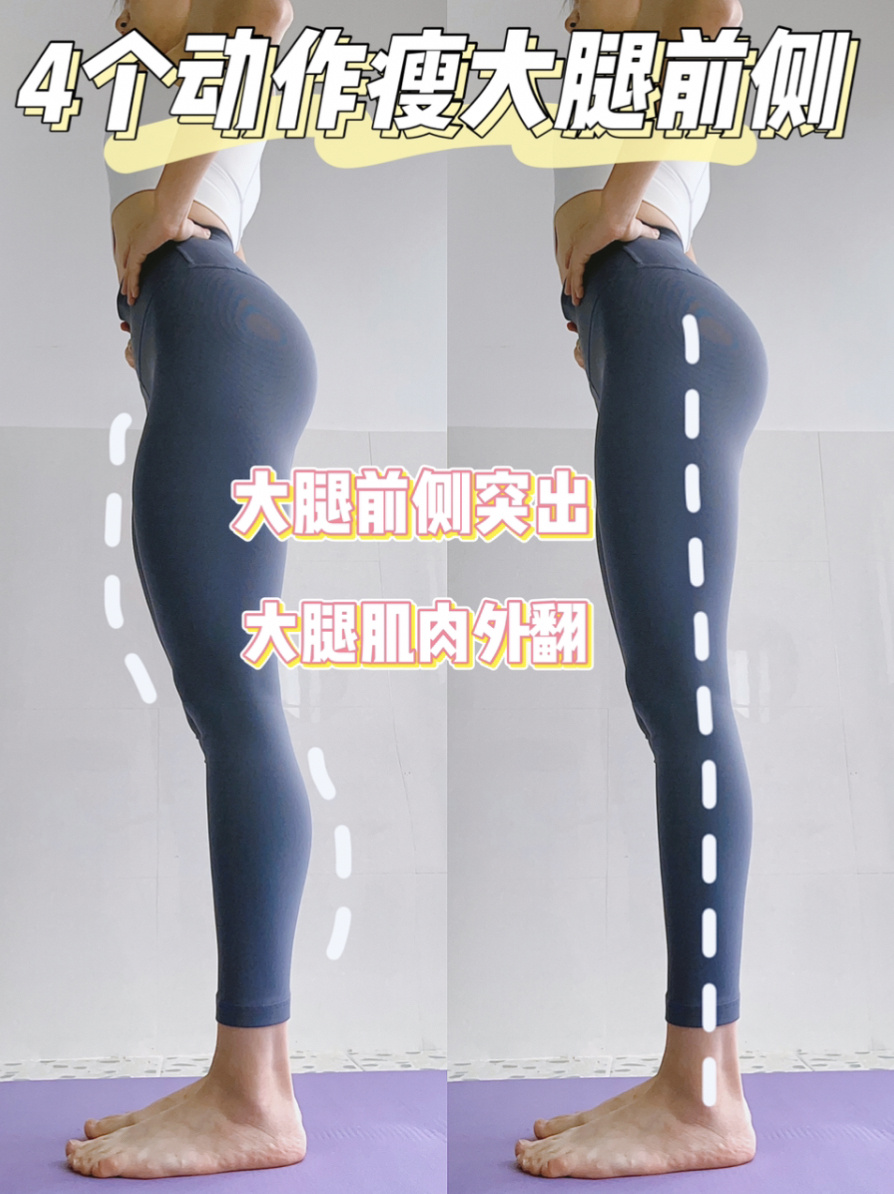 瘦大腿|四个动作改善大腿前侧凸出外翻