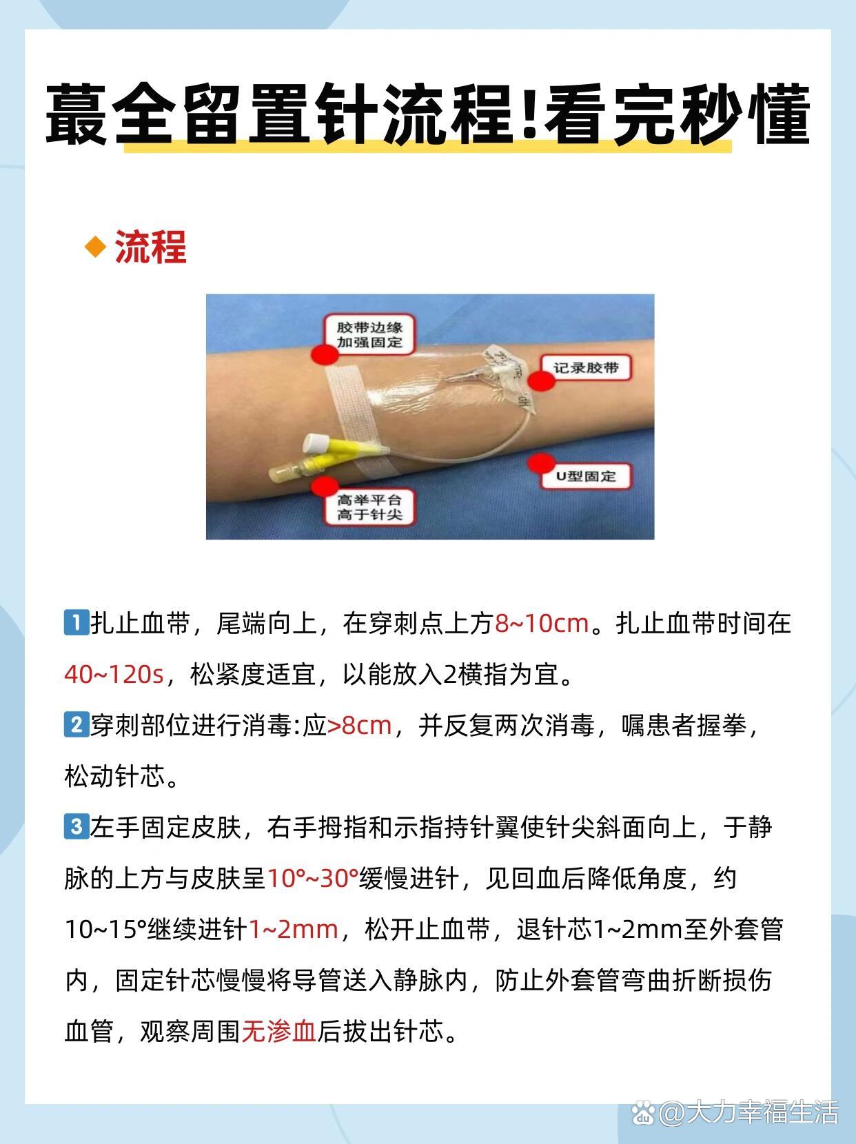 留置肛管固定方法图片图片