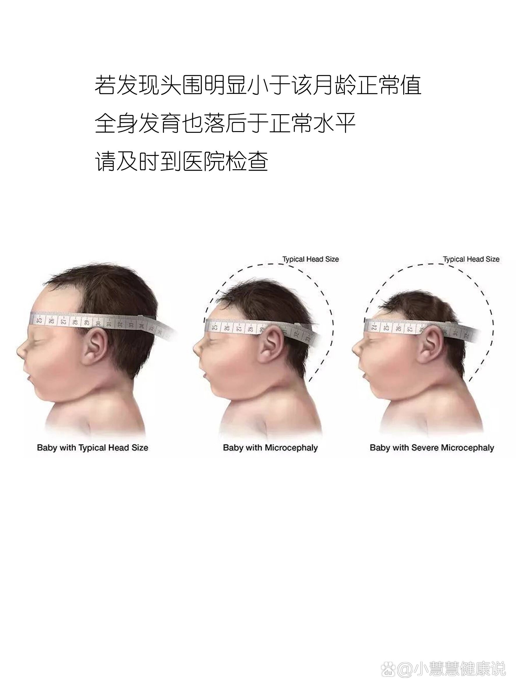 后囟门位置图图片