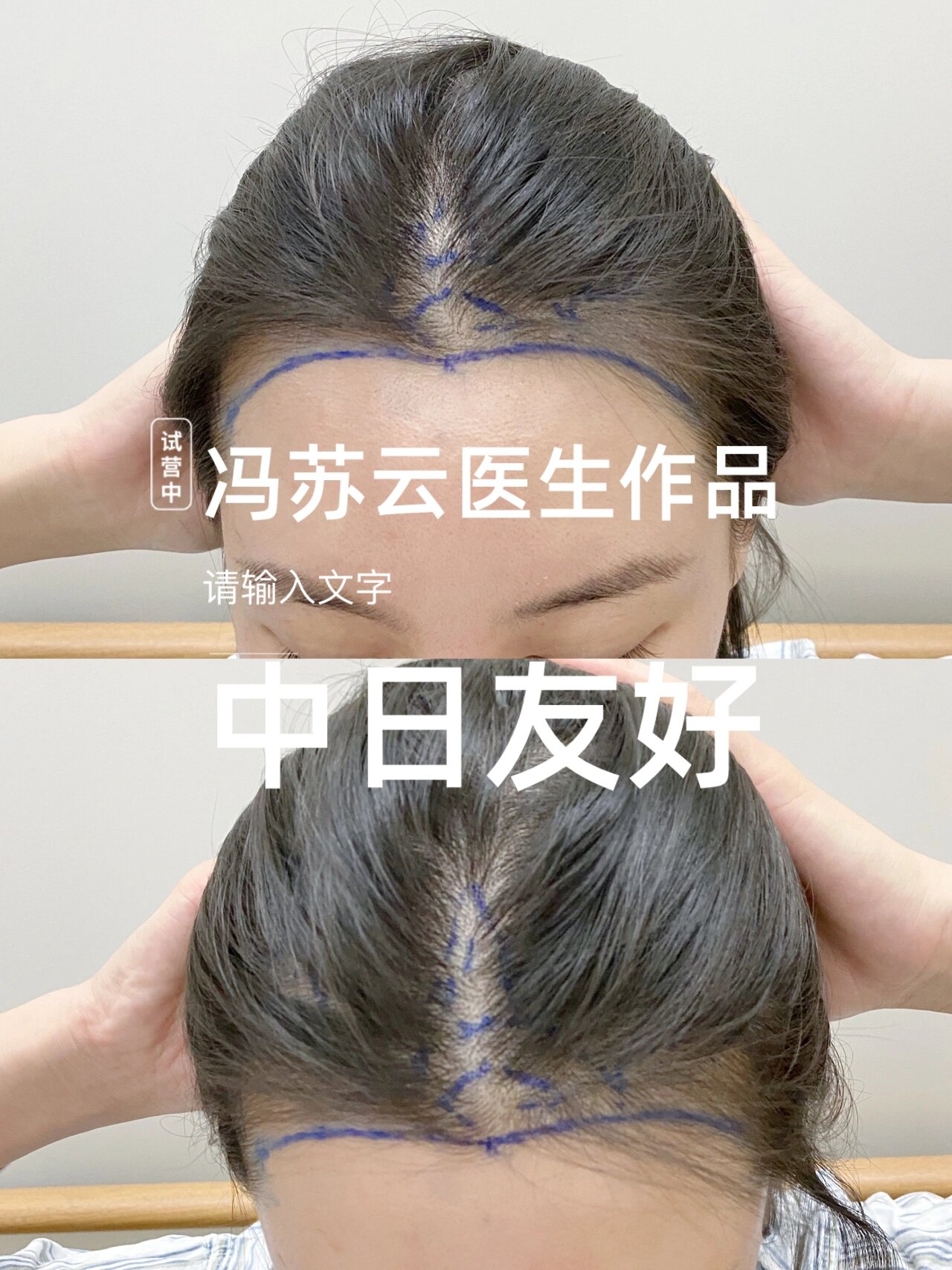 中日友好医院医疗预约流程引导-中日友好医院网上预约挂号取号流程 中日友好医院医疗预约流程引导-中日友好医院网上预约挂号取号流程