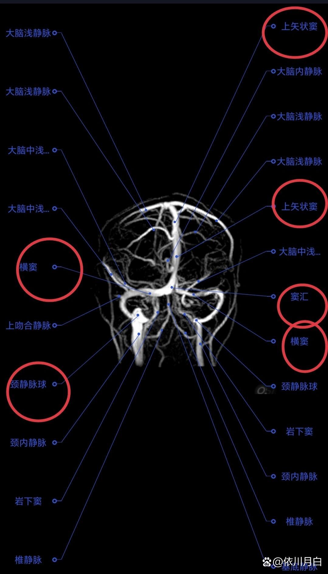 颅内血管断层解剖图图片