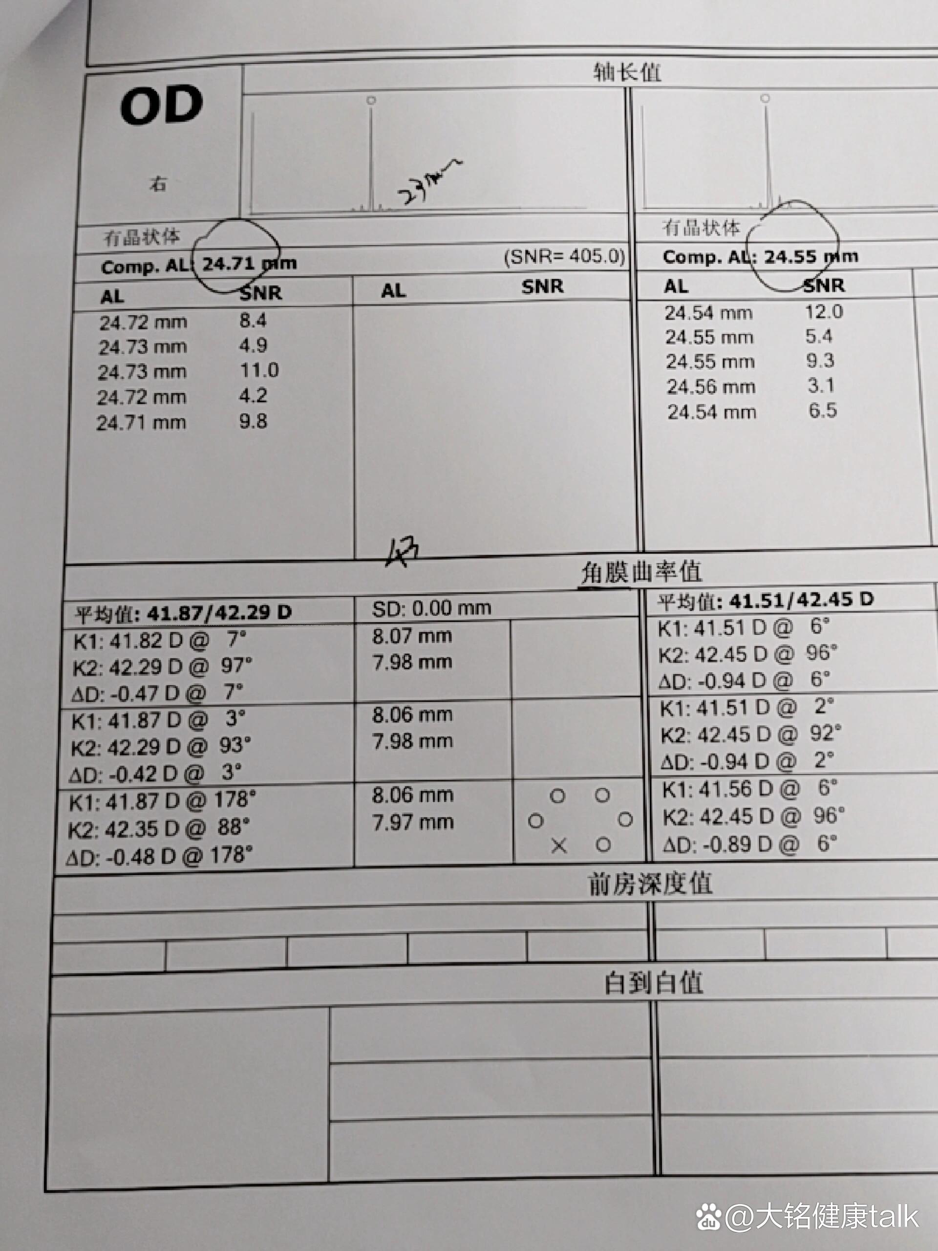 角膜曲率值单子怎么看图片