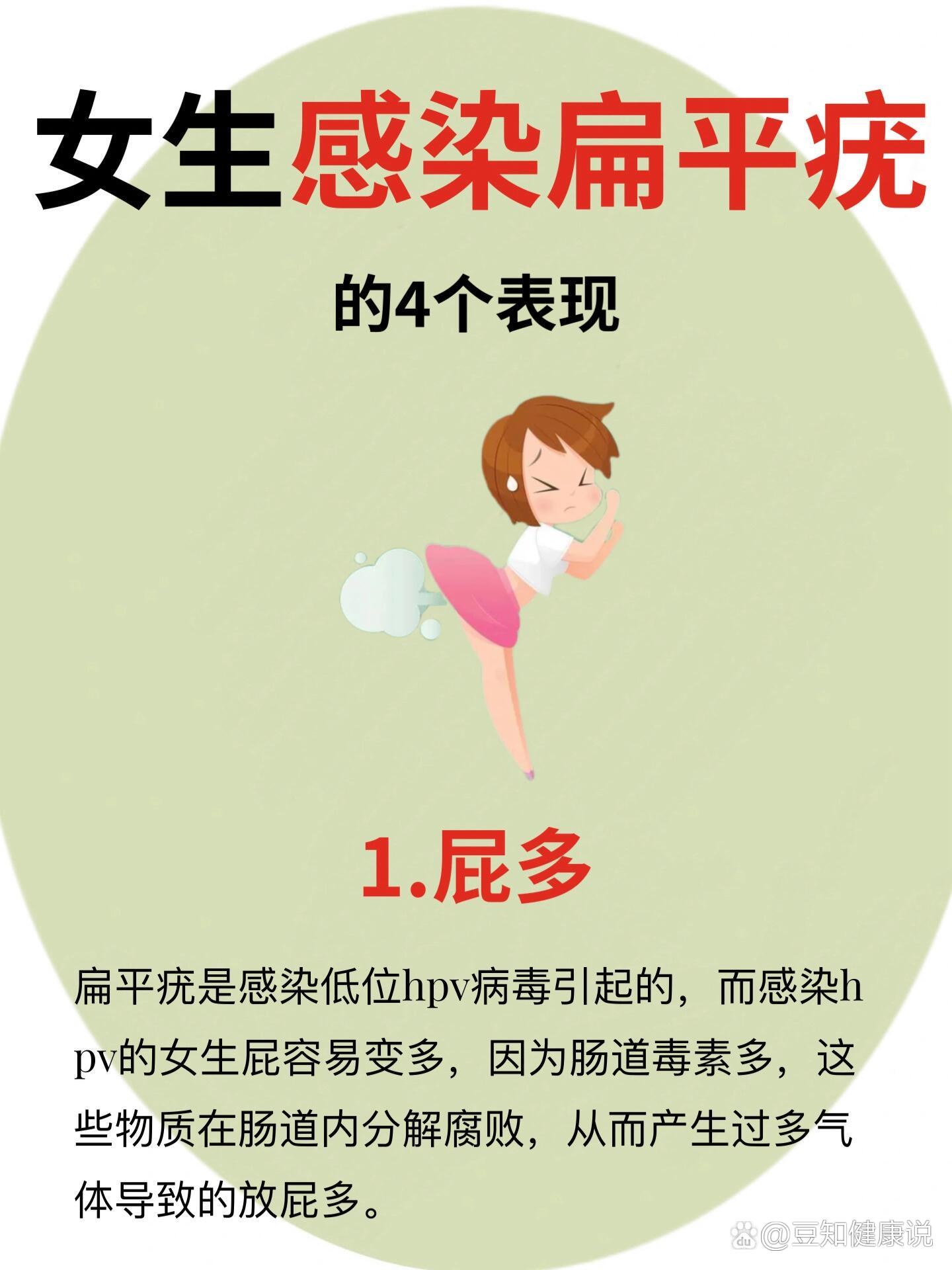 乳房上长扁平疣怎么办图片