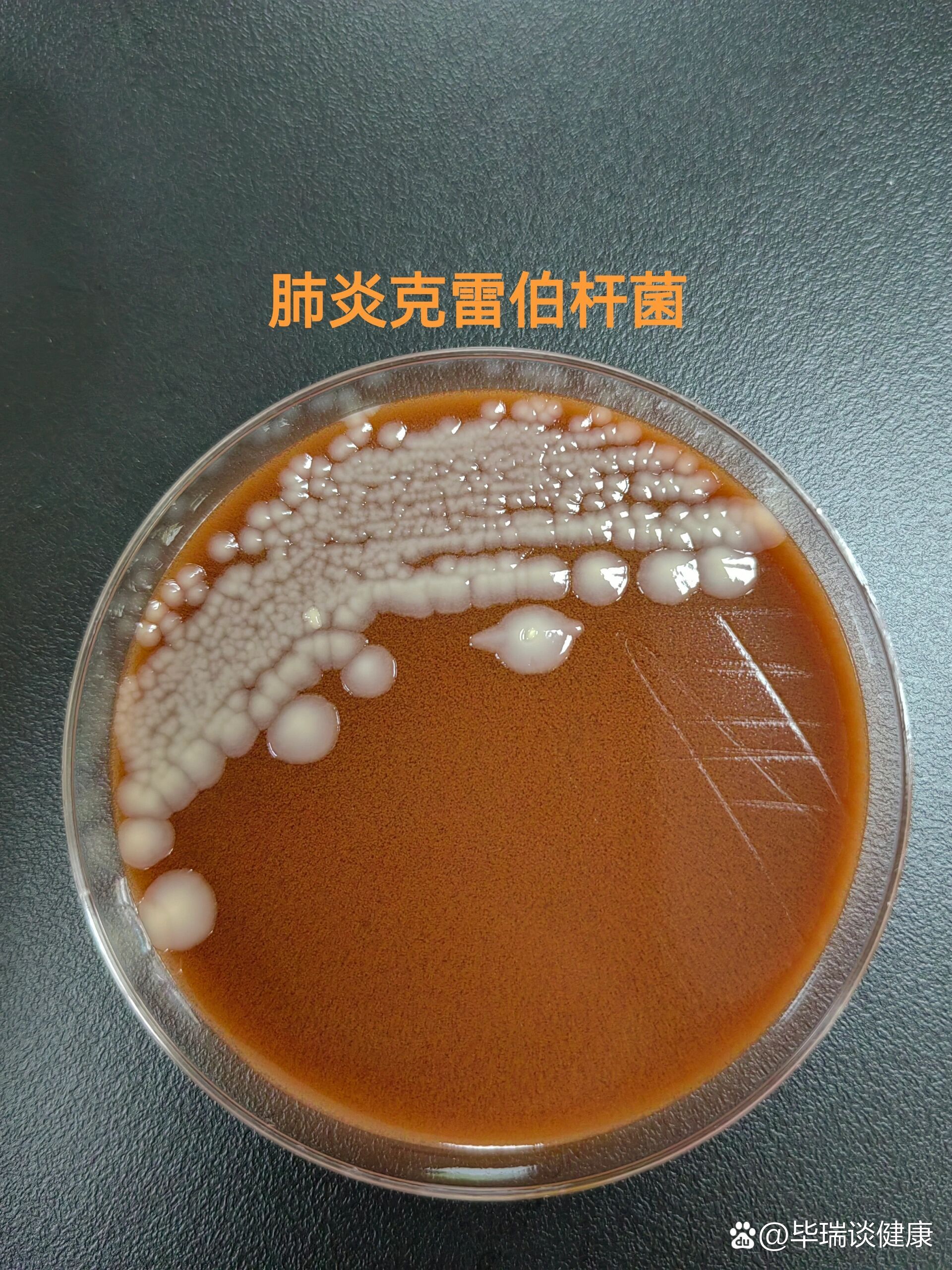 肺炎克雷伯菌 全网资源