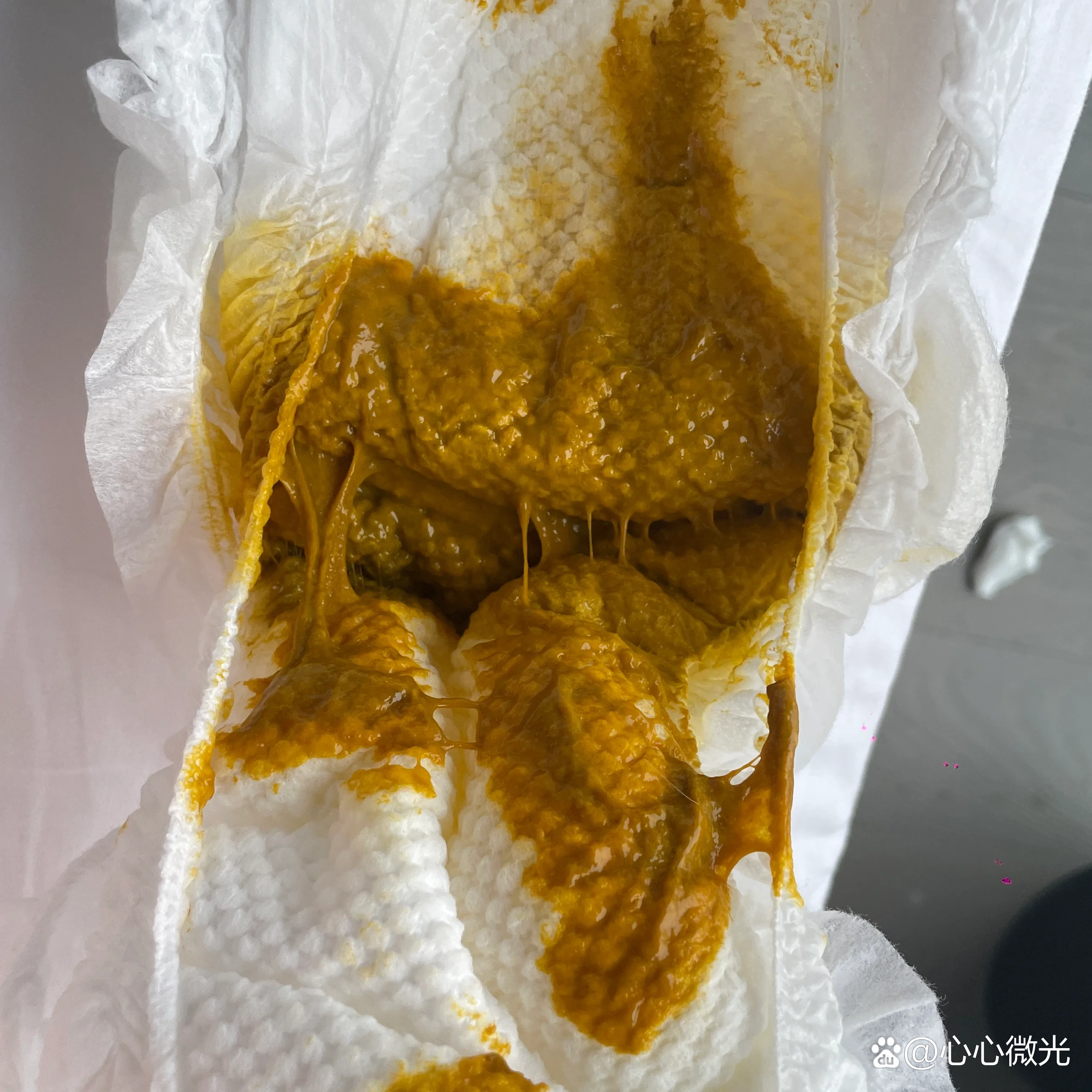 这种便便