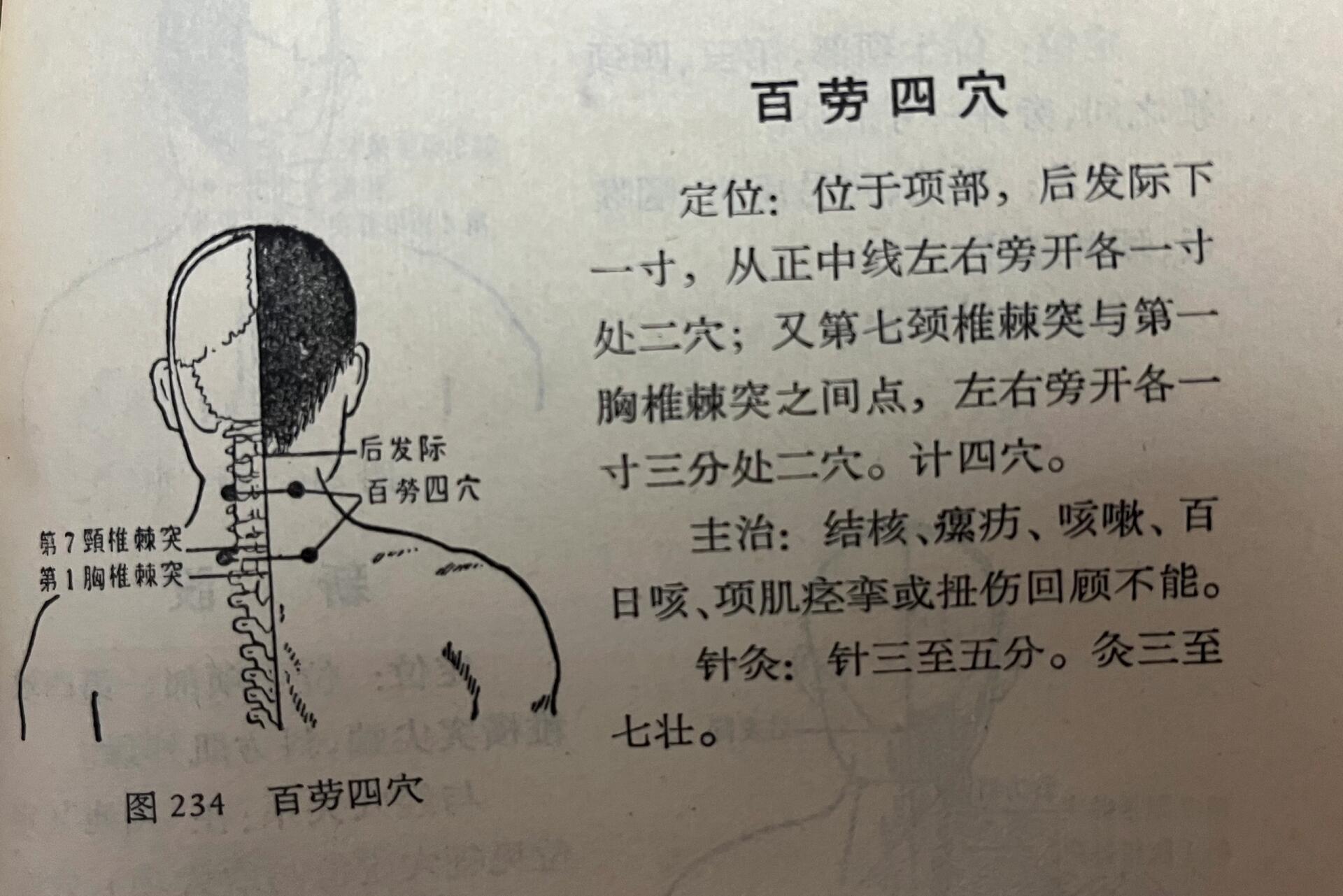 颈百劳的准确位置图图片